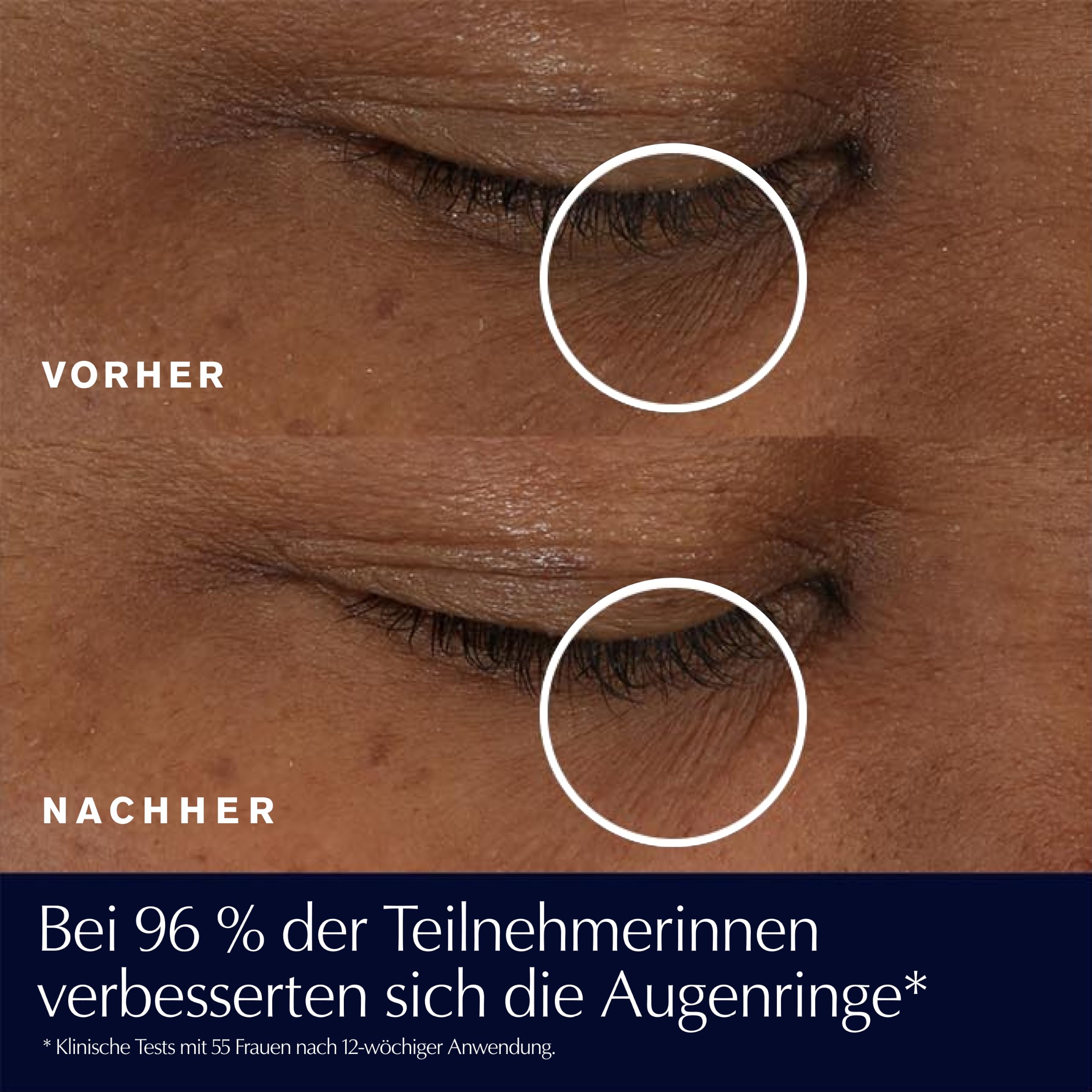 Estée Lauder Advanced Night Repair Eye Supercharged Gel-Cream | Augenpflege | Mildert sichtbar Augenringe & Falten | 100 Stunden Feuchtigkeit mit Hyaluronsäure, 15ml