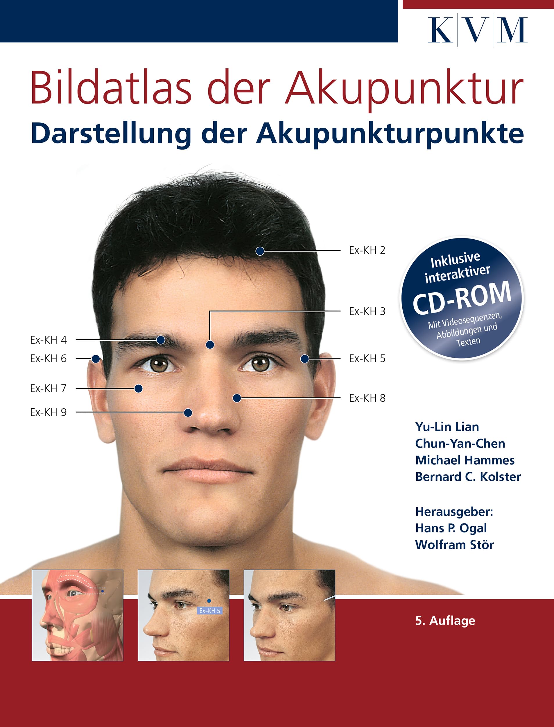 Bildatlas der Akupunktur: Darstellung der Akupunkturpunkte (inkl. CD-ROM)