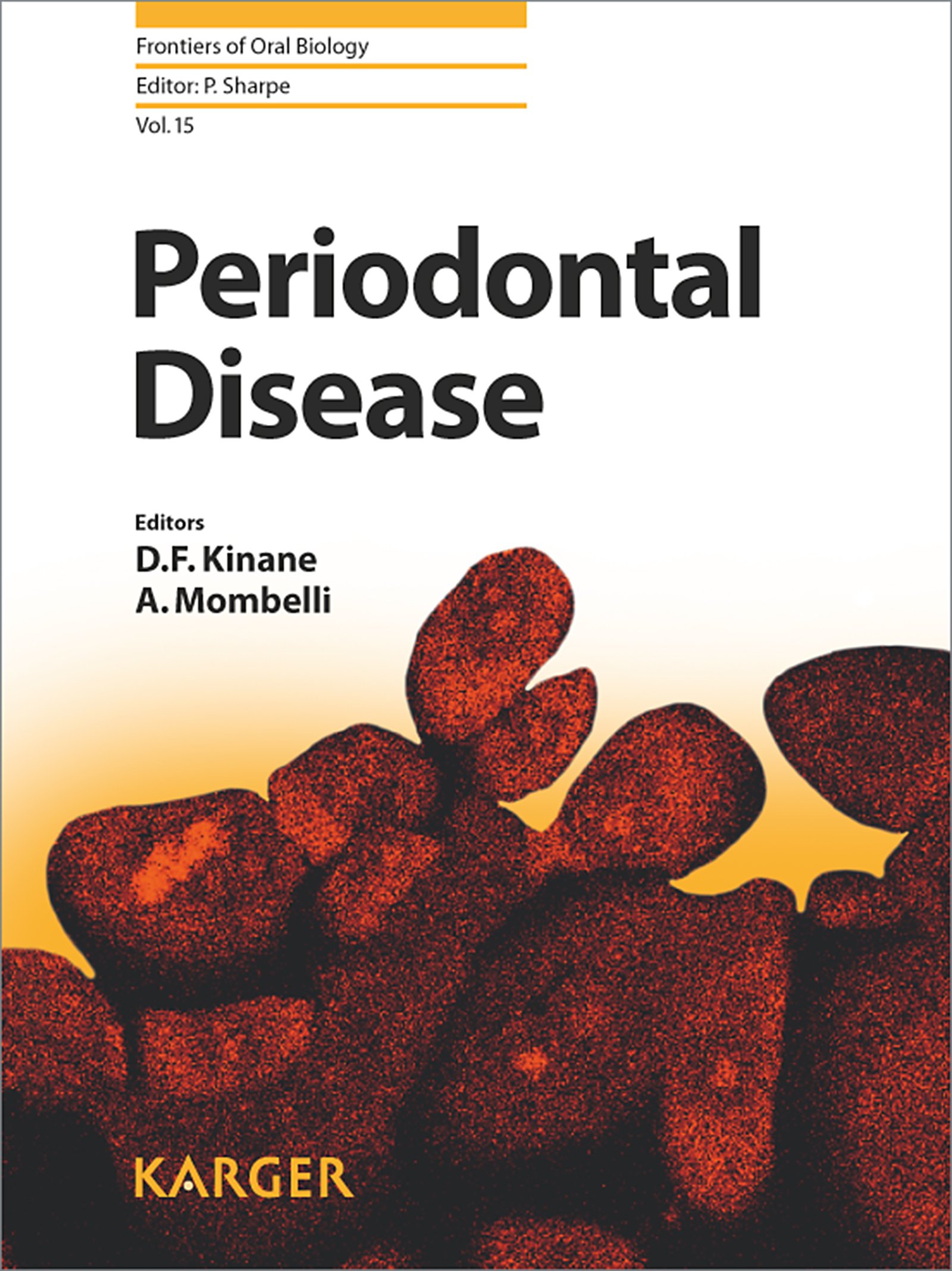 Periodontal Disease (Frontiers of Oral Biology Book 15) (English Edition)