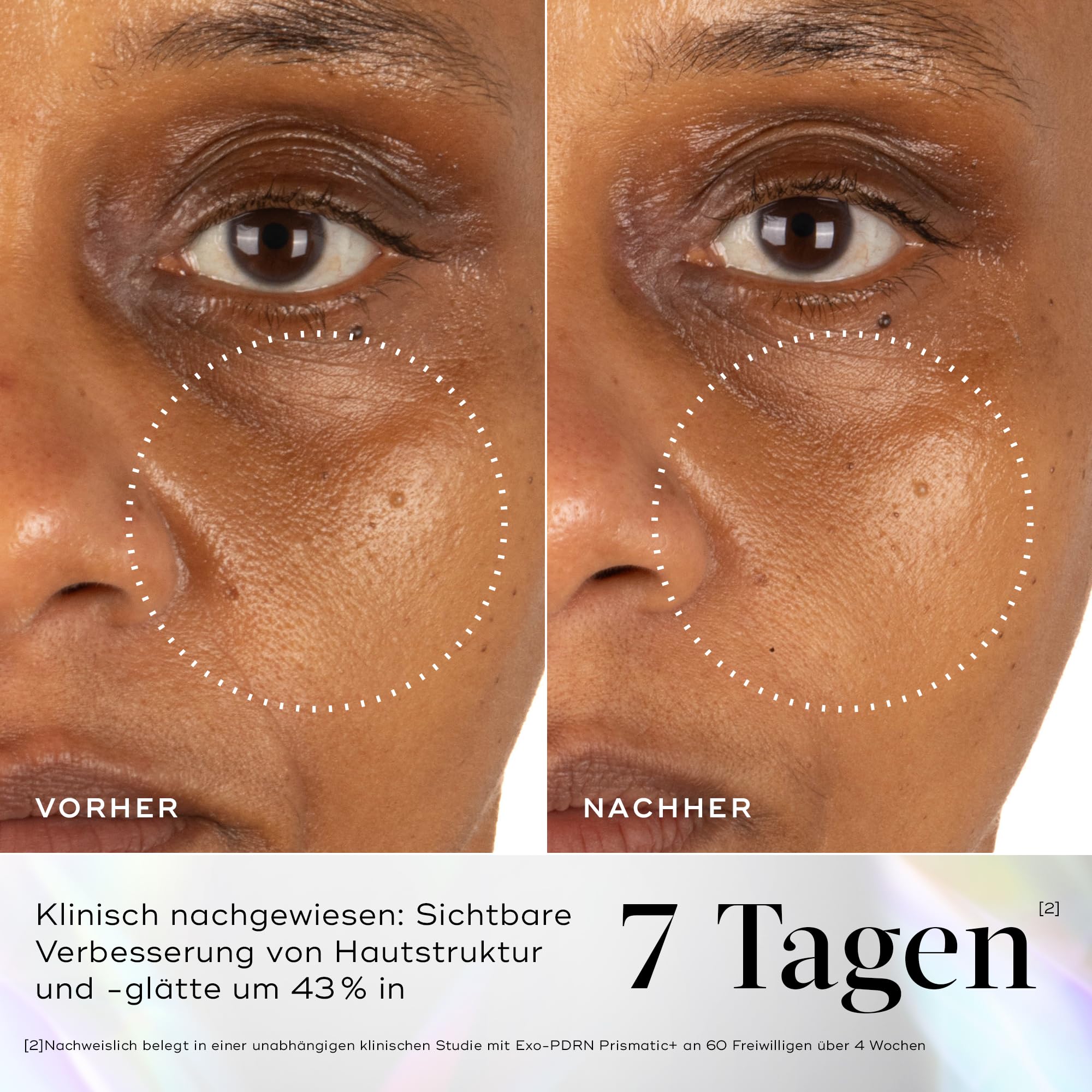 Medik8 Exo-PDRN Prismatic+, Serum für Vitalität, Triple-Exosom - 30 ml | Inspiriert von Polynukleotid-Behandlungen; 60% tieferes Eindringen als Lachs-DNA; prismatisches PDRN, 3-fach Exosom-Komplex