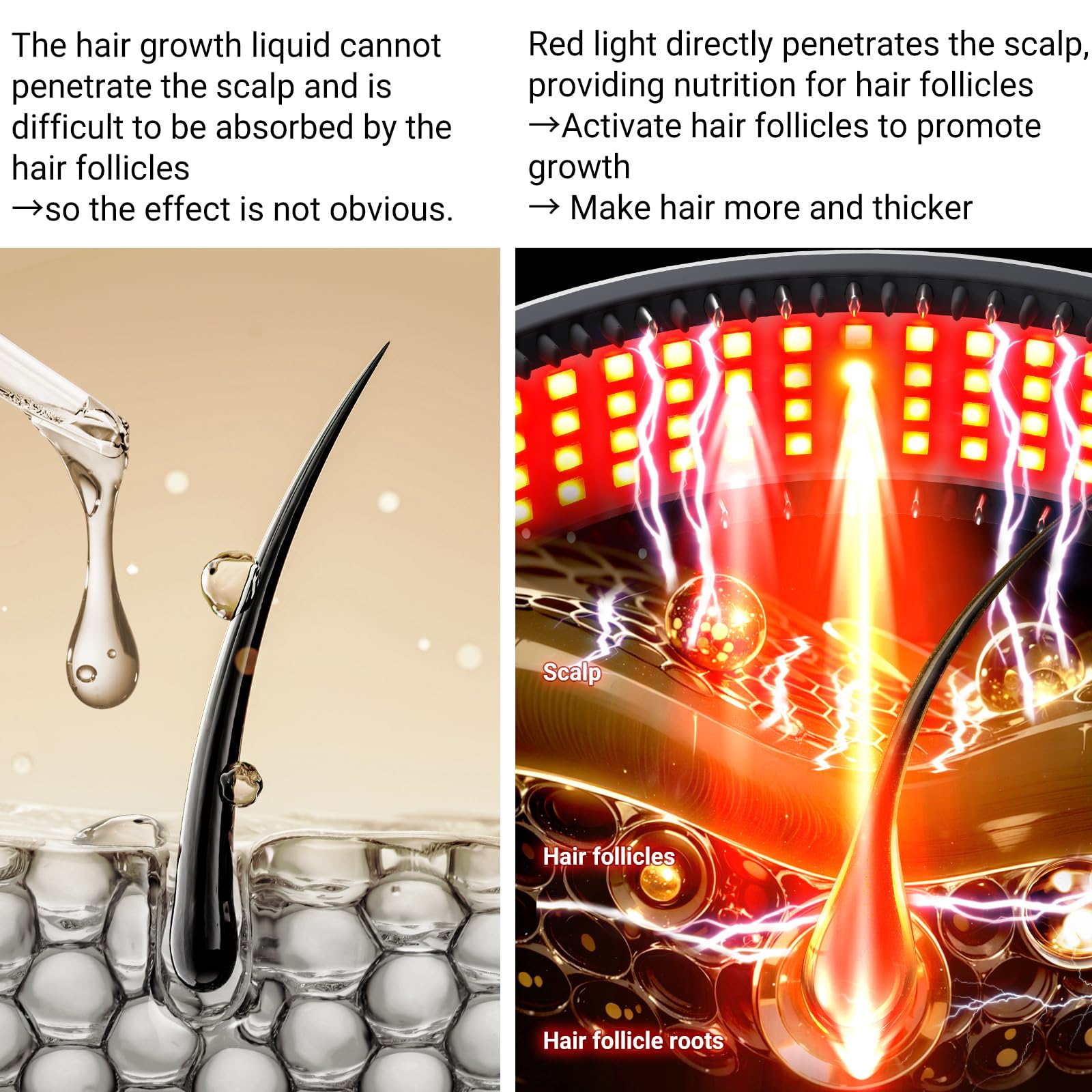 Led Licht-Therapie Haarwachstum Gerät mit 88 Lampenkugeln Haarwuchsfördernde Gerät, Haarausfall-Behandlung Für Männer Und Frauen