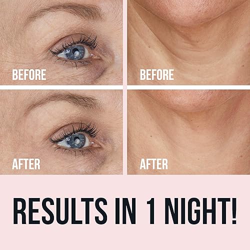 Vista 11 de Facelift Par