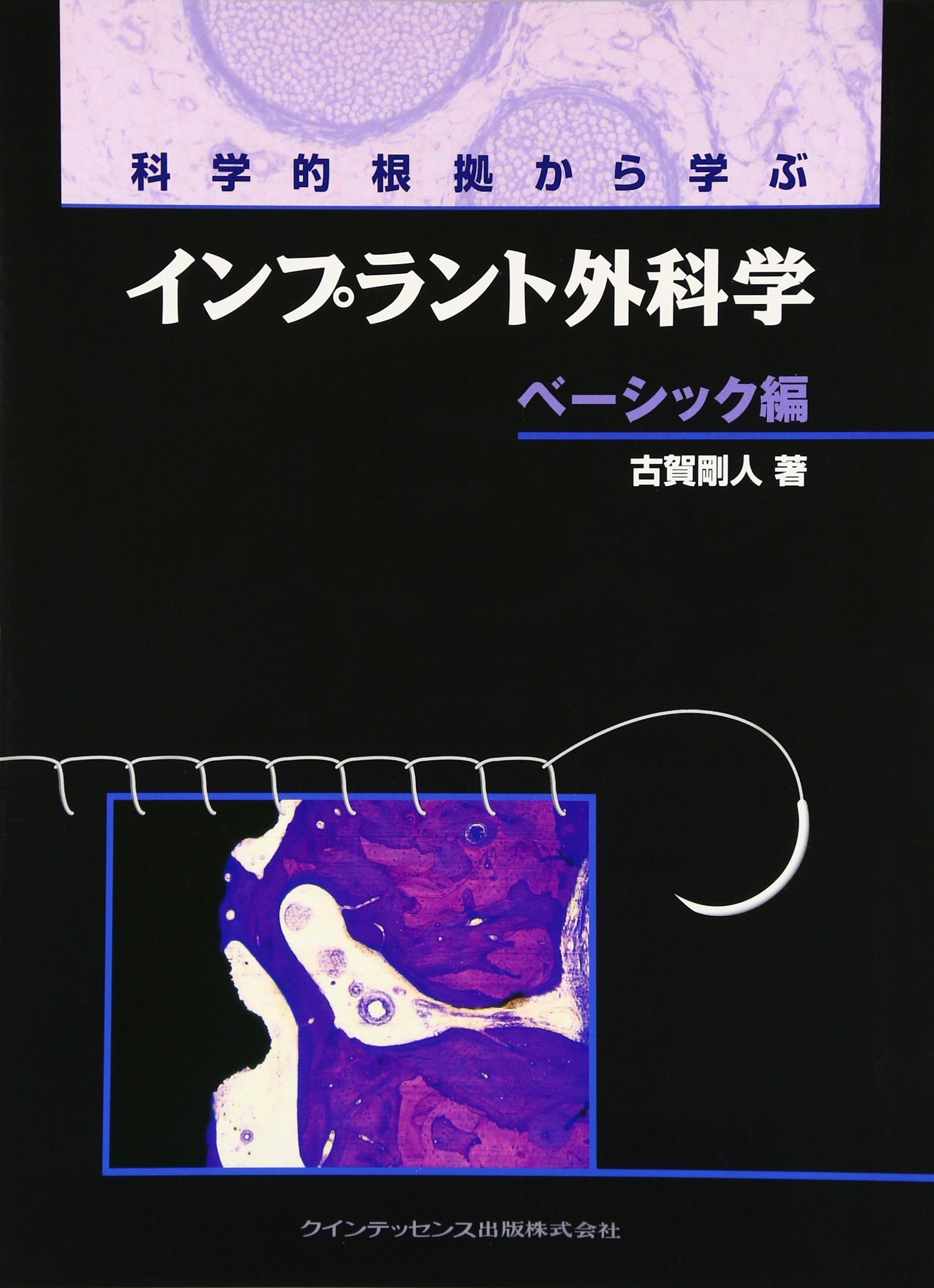 【極美品】科学的根拠から学ぶインプラント外科学 応用編 Amazon.co.jp: 科学的根拠から学ぶインプラント外科学 応用編