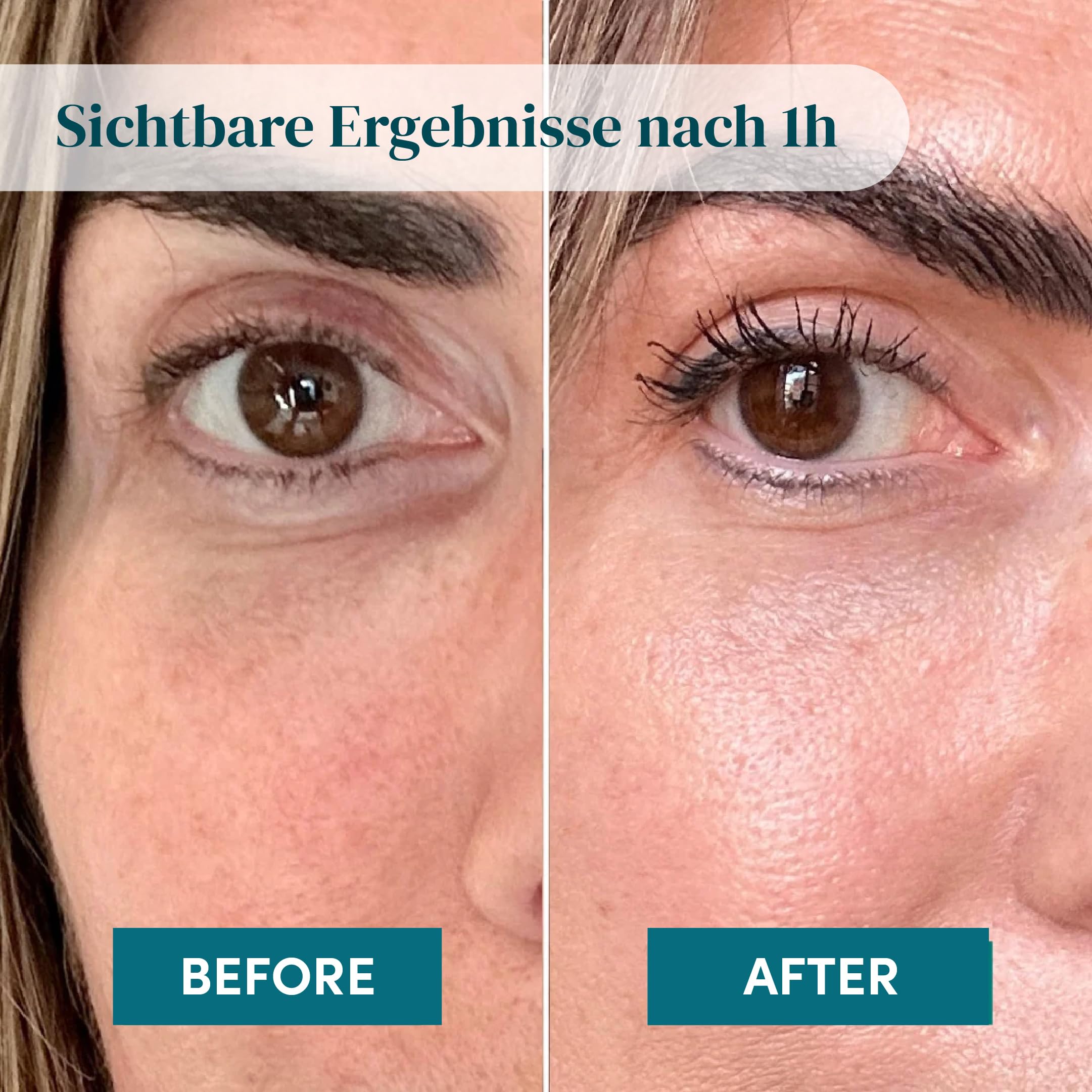 APRICOT Hyaluron Augenpads aus medizinischem Silikon mit niedermolekularem Hyaluron - Bis zu 30x Wiederverwendbar, Dermatologisch Bestätigt, Vegan & Tierversuchsfrei - Augenpads gegen Augenringe