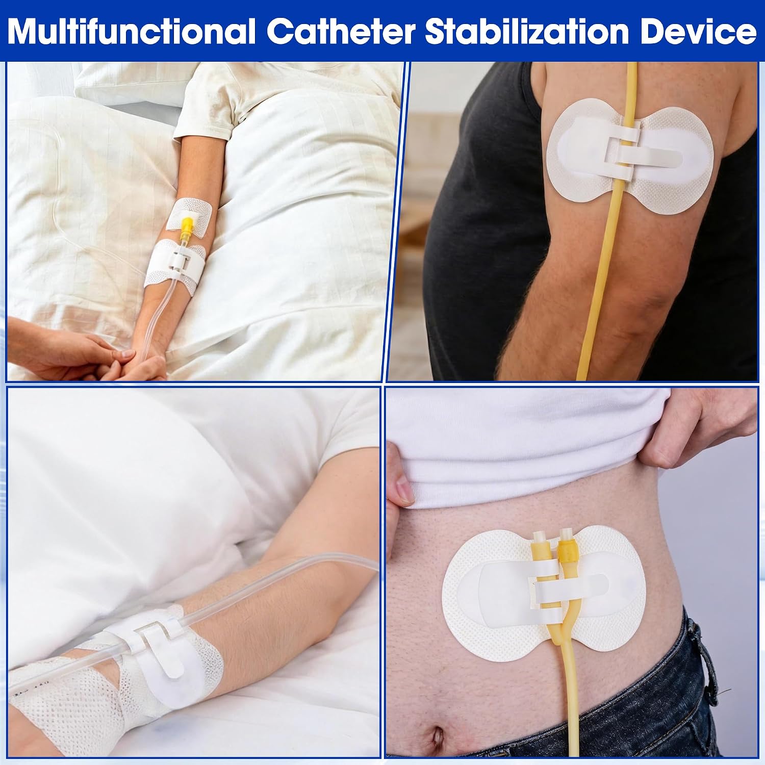 6Pcs Foley Catheter Stabilization Device, Large Size Catheter Tube Holder, Urinary Leg Bag Catheter Supplies for Single/Double/Feeding Tube, Adhesive Catheter Urinary Leg Bags Holder，White