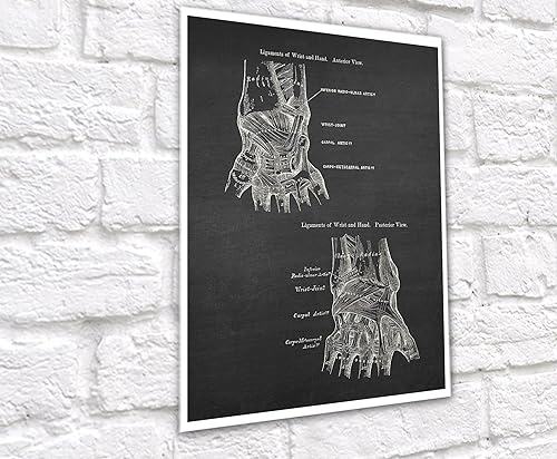 Miniatura 5 de Gnosis Picture Archive Anatomía de huesos de mano médica, juego de 3 impresiones artísticas sin marco, decoración ortopédica de oficina