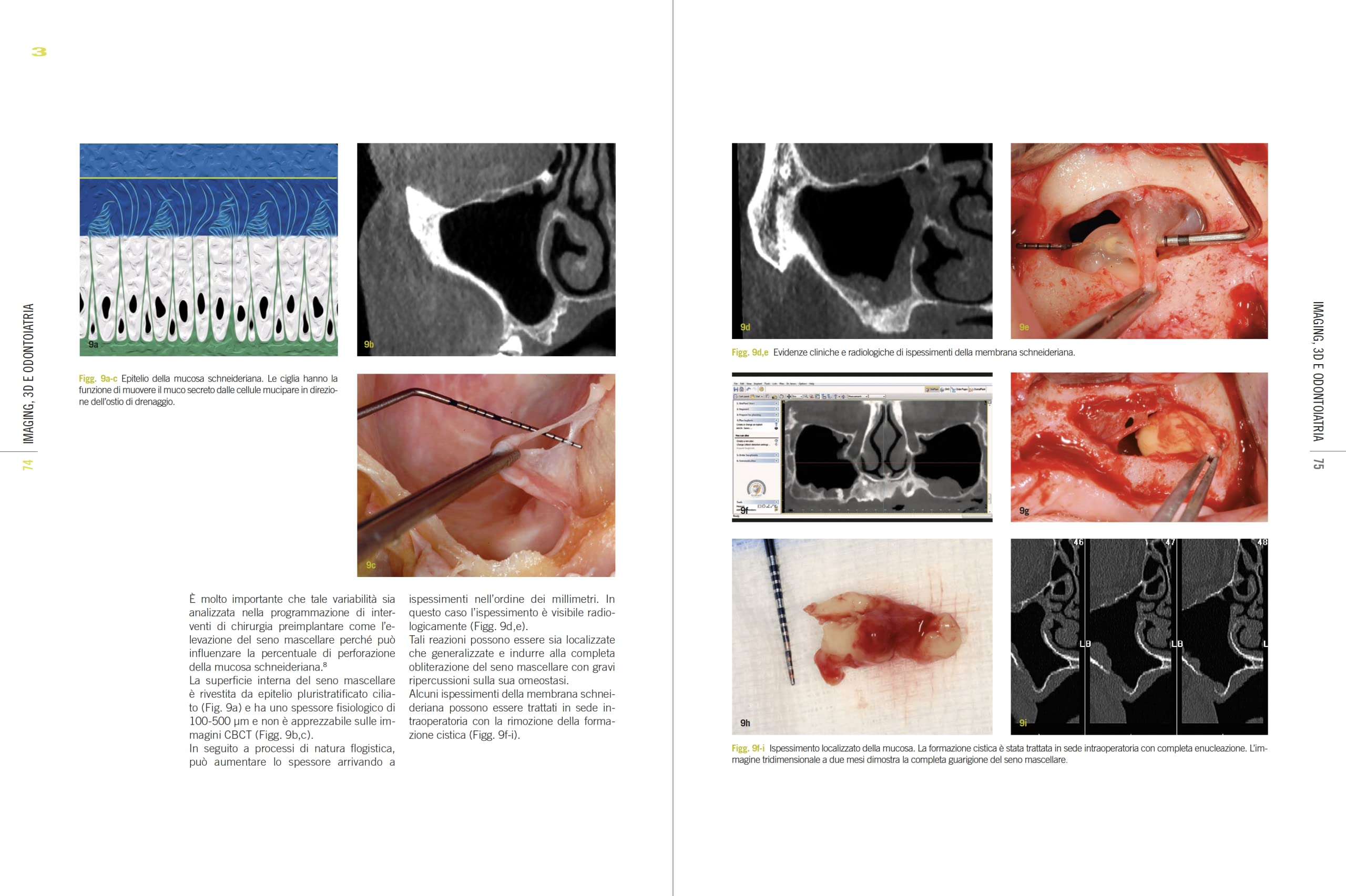 Imaging, 3D e odontoiatria. Dalla cefalometria multiplanare alla navigazione guidata in implantologia