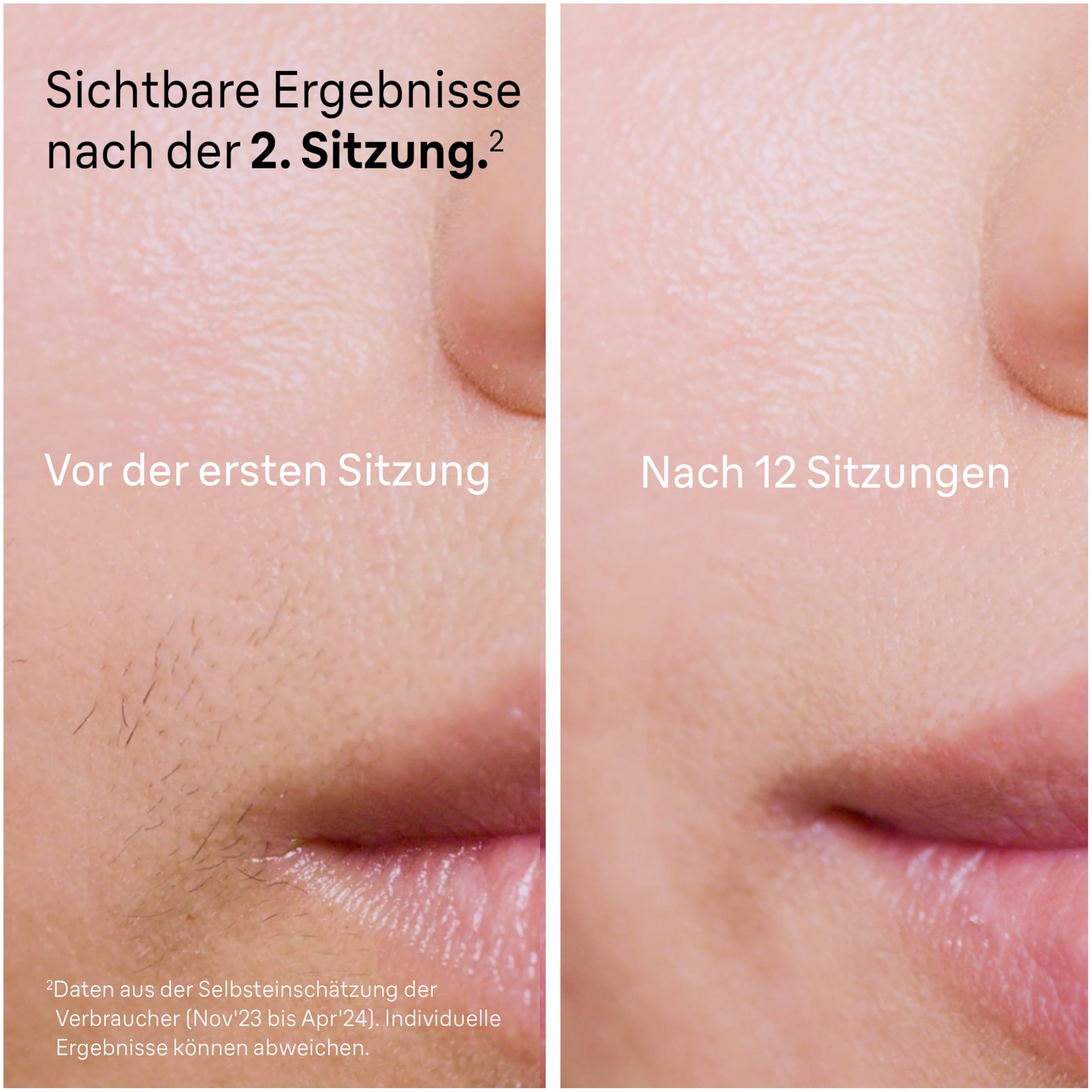 Braun IPL Geräte Haarentfernung Silk·expert Pro 5, PL5342, Weiß/Gold - Alternative Laser Haarentfernung für Zuhause, Dauerhafte Haarentfernung, Inkl. Etui, Venus Rasierer Und 4 Aufsätze