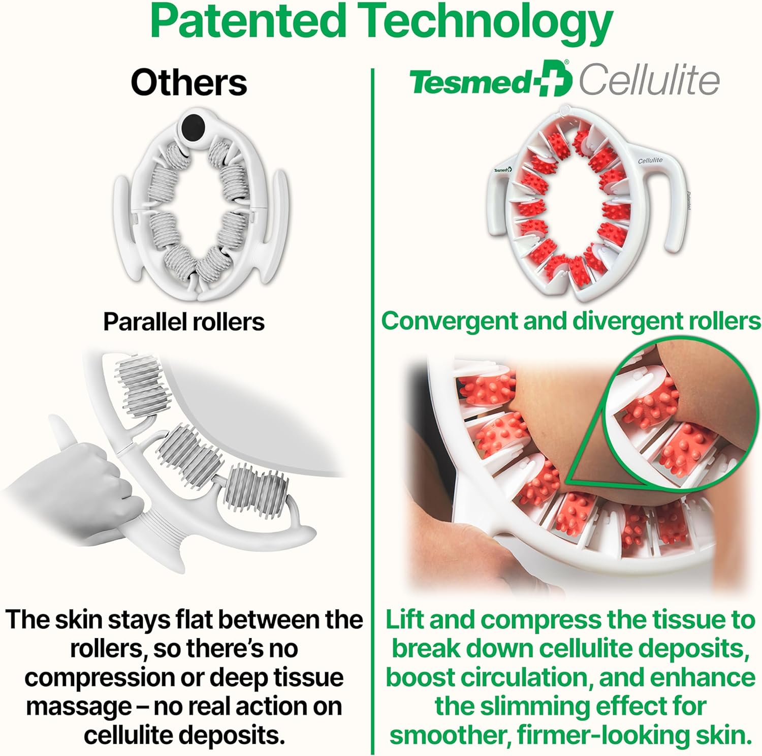 TESMED Cellulite Manual Massager : Made in Italy, Patented with Converging & Diverging Roller Technology. Anti Cellulite Roller for Thighs and Buttock - Image 6