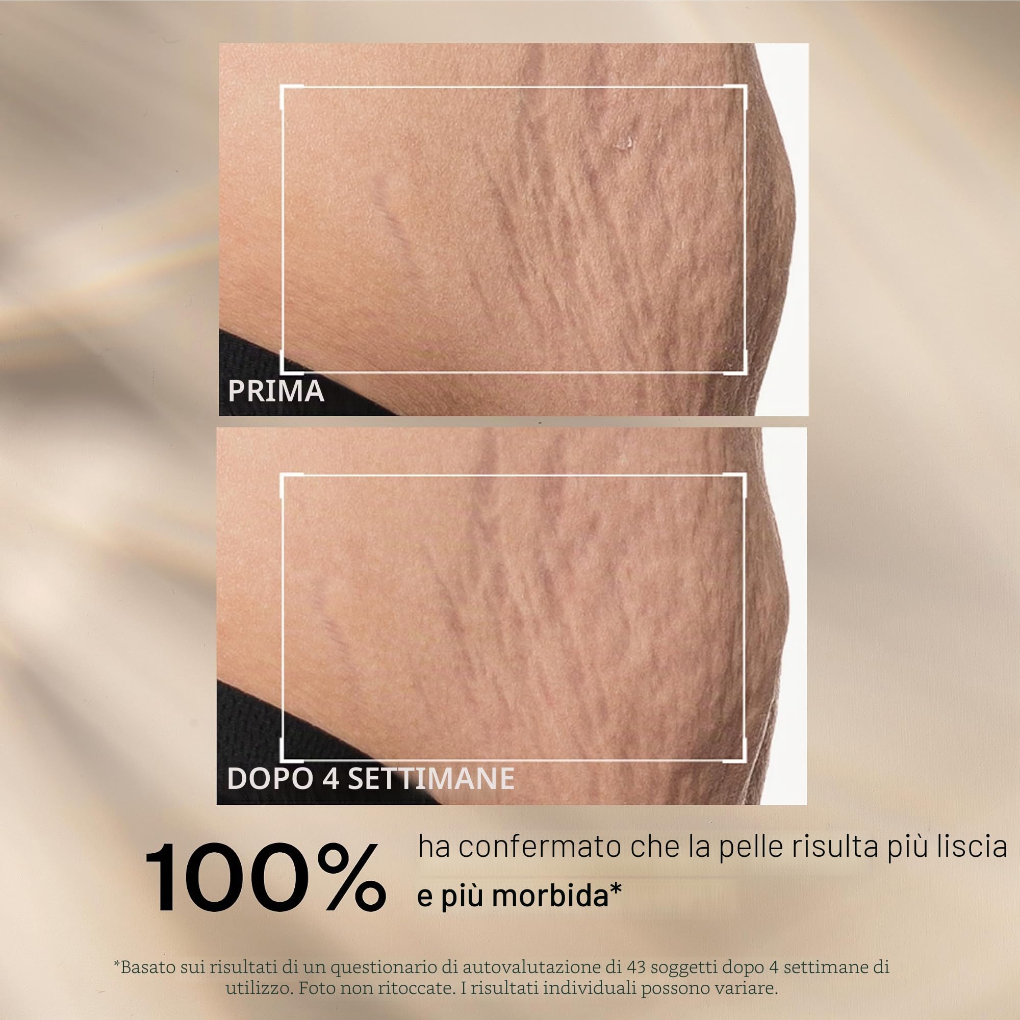 StriVectin SD Advanced™ Plus Crema idratante intensiva per rughe e smagliature, per viso e corpo, potenziamento del collagene con peptidi e acido ialuronico