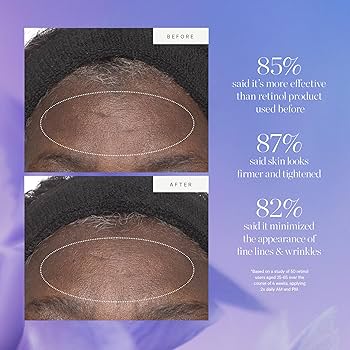 Amazon.com: KORA Organics Plant Stem Cell Retinol Alternative