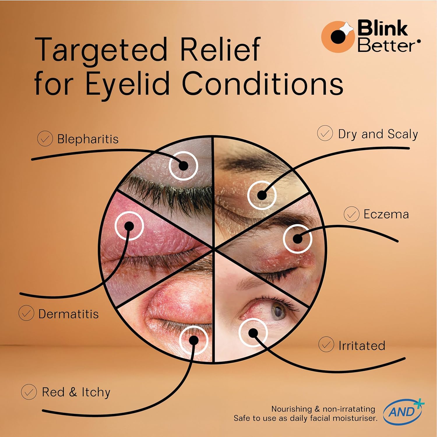 BlinkBetter® Restore Eyelid Cream – 3% Oat Extract & Ceramide Complex – Soothing Hydration & Barrier Support for Dry, Itchy, Red, Sensitive, or Flaky Skin Around the Eyes – All-Day Use – 1oz - Image 4