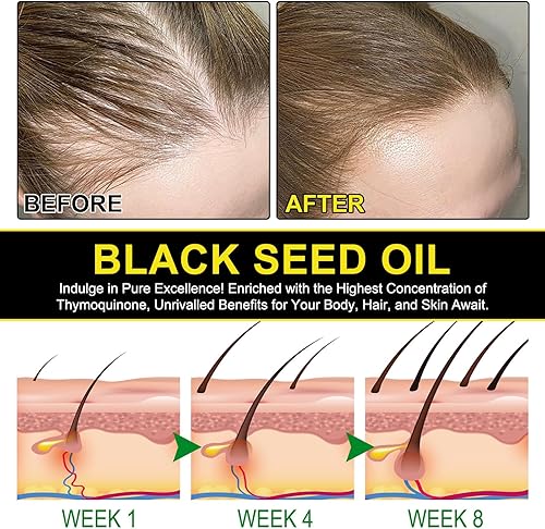 Miniatura 7 de Aceite de semilla negra  Aceite de semilla negra 100% virgen prensado en frío de alta calidad, antioxidante Omega 3 6 9, refuerzo inmunológico,