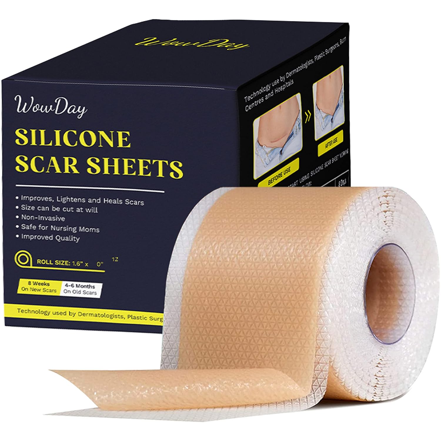 Buy Silicone Scar Sheets 1.6" x 120" 3M Medical Grade Silicone Scar