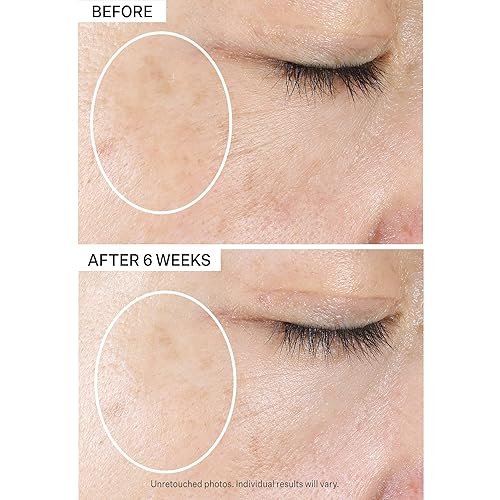 Miniatura 9 de StriVectin Multiacción Super-C SPF 30 Hidratante de vitamina C y protector solar diario para iluminar y suavizar líneas finas, 1.7 onzas líquidas