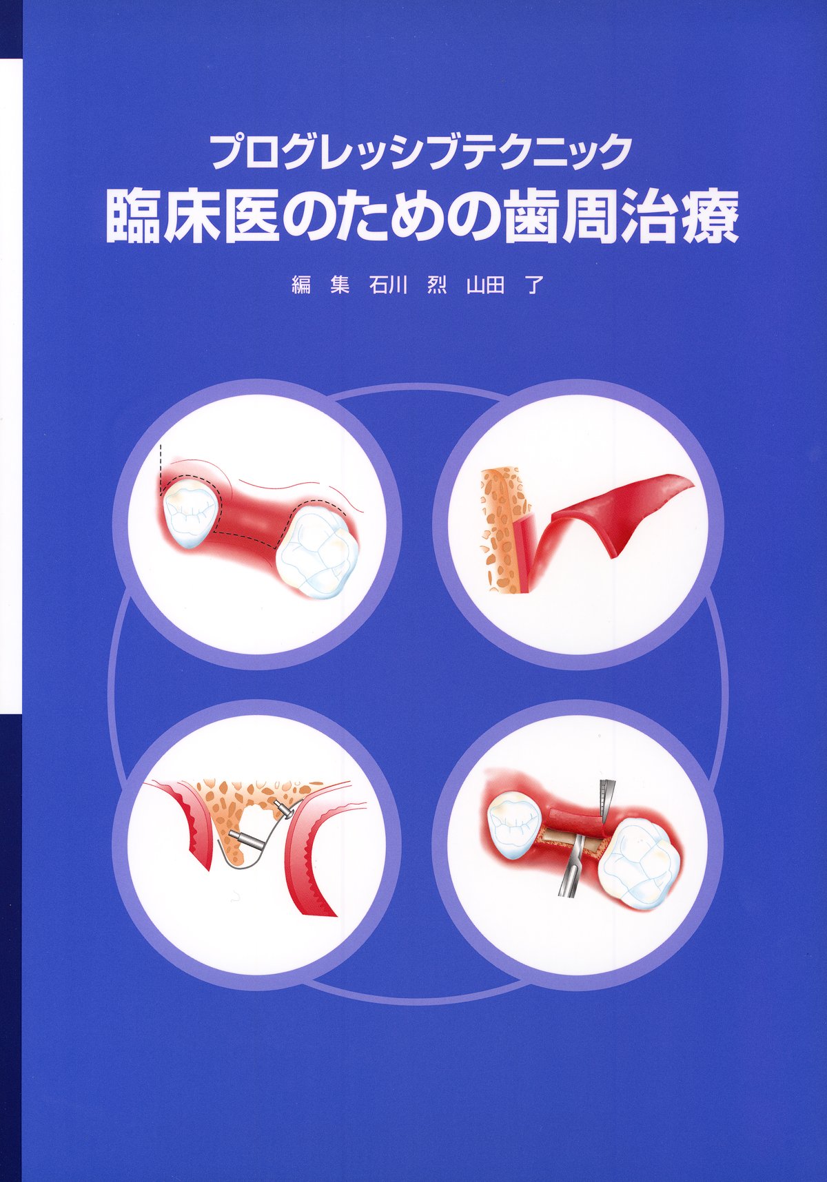 プログレッシブテクニック 臨床医のための歯周治療 | 石川 烈