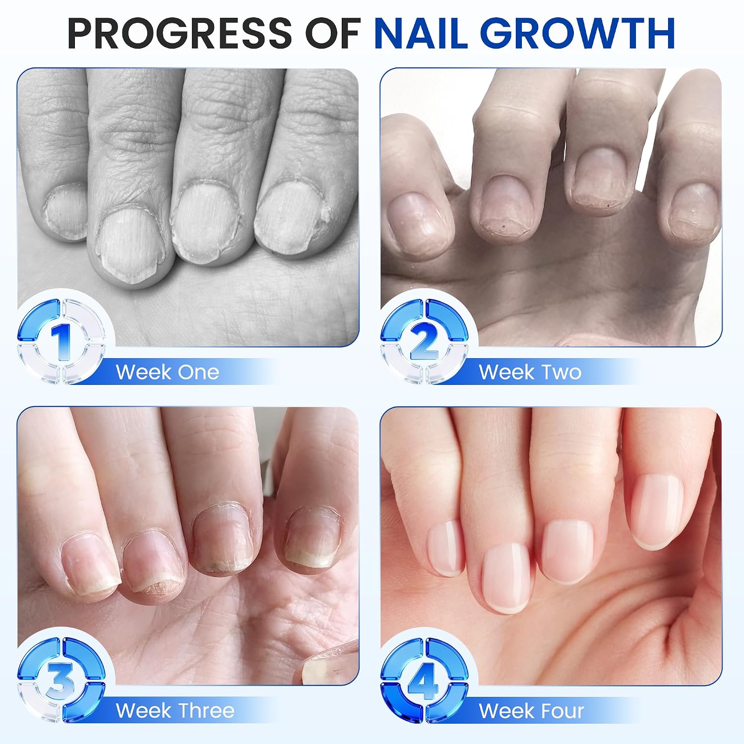 Nail Biting Treatment for Kids & Adults Clear Nail Polish for Nail Biting Prevention, Nail Strengthener & Growth, All-in-One Nail Care Solution, Thumb Sucking Deterrent for Nails 15 ml 0.5 oz