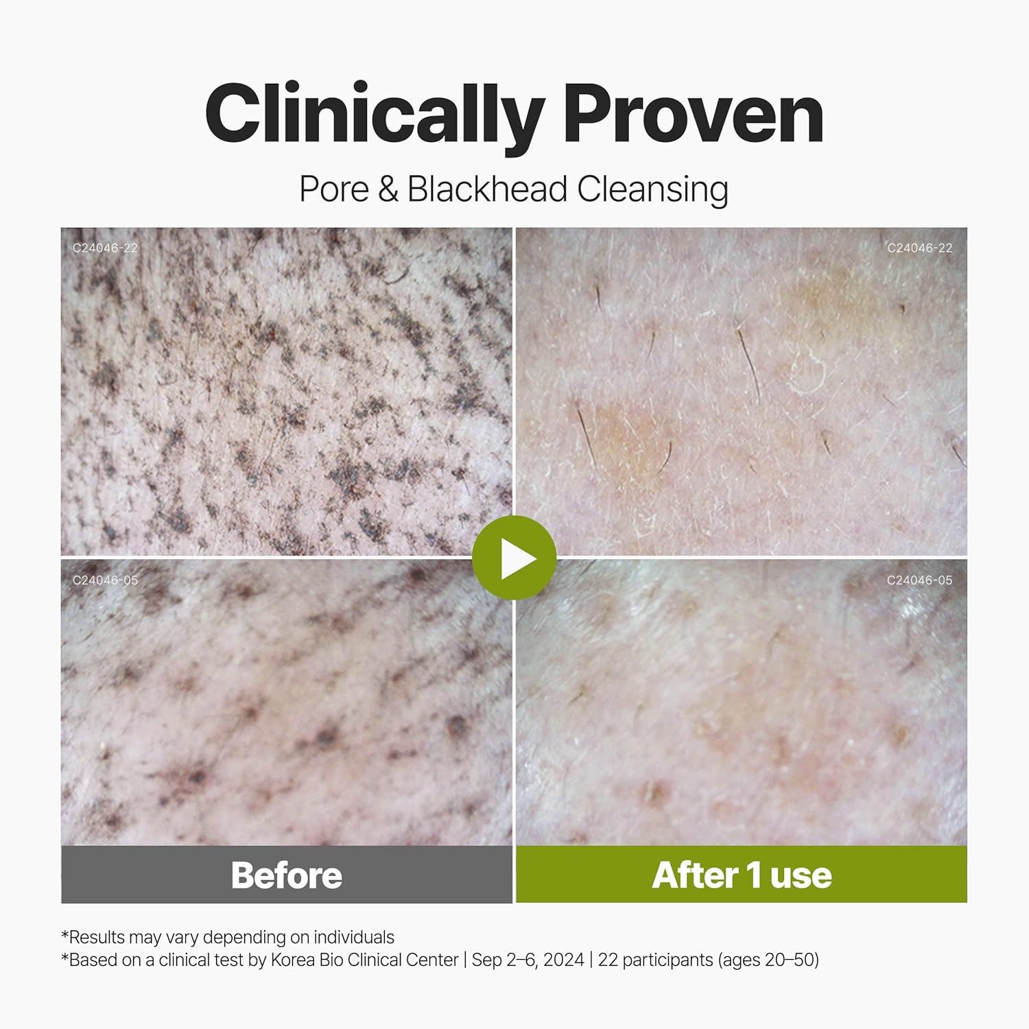 P.CALM Holy Basil Bubble Deep Mask 2EA + BRUSH – Holy Basil & Carbonated Water for Cleansing Pores & Blackheads, Korean Clay to Bubble Wash-Off Pack, Stocking Stufffers (2EA x 90g / 3.17 oz)