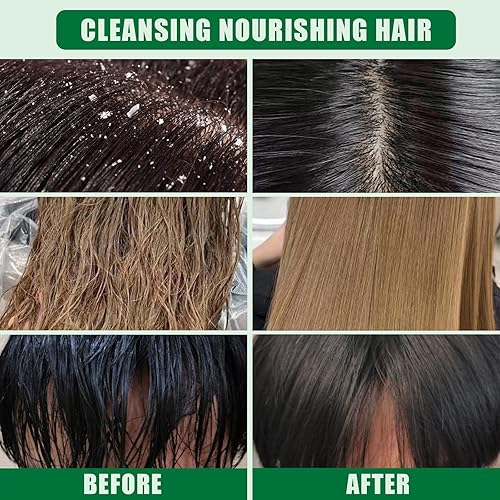 Miniatura 5 de Barra de champú y acondicionador sólido 2 en 1, champú en barra de cítricos para cuero cabelludo seco, picazón y graso, pH equilibrado, barras