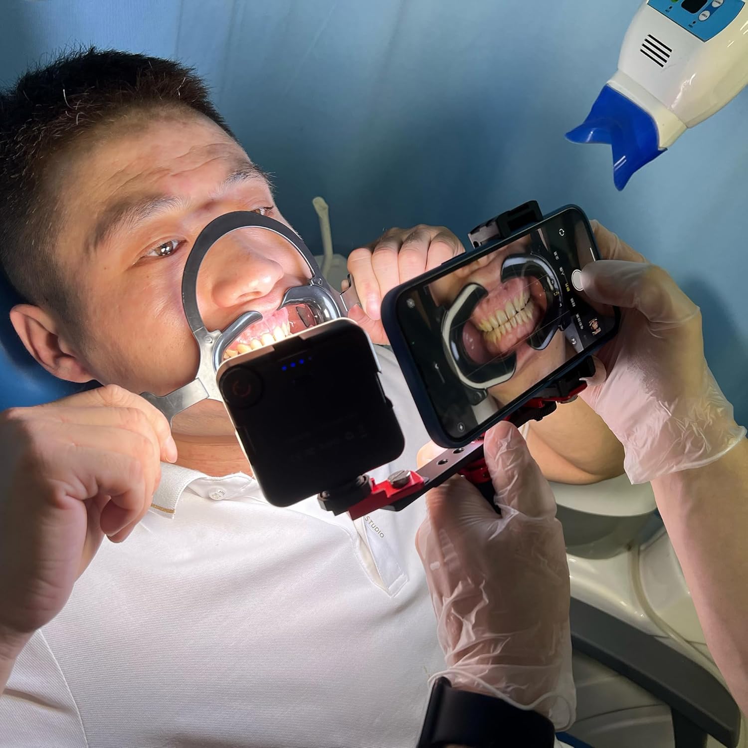 MK16 v2 Dental Photography Light for Cellphone - Intraoral Photos and Videos with a Phone for Dentist