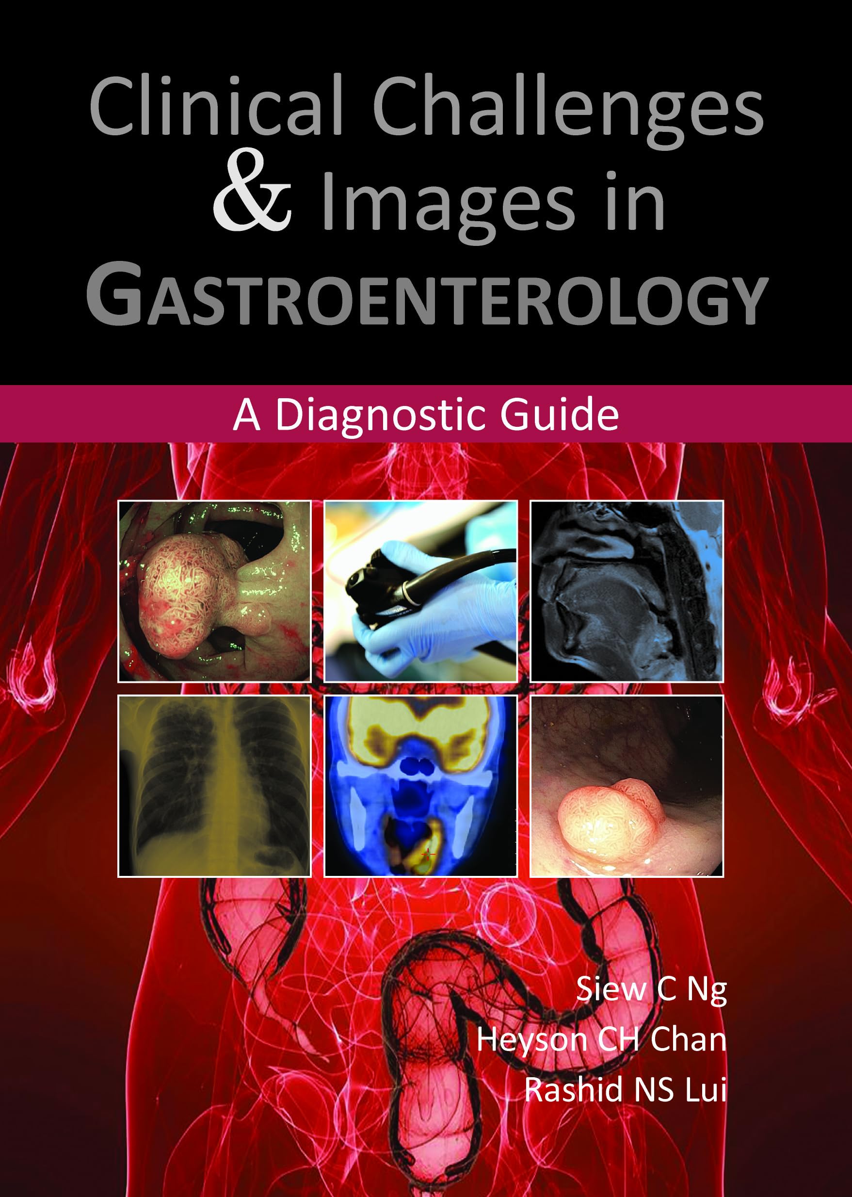 Clinical Challenges and Images in Gastroenterology: A Diagnostic Guide