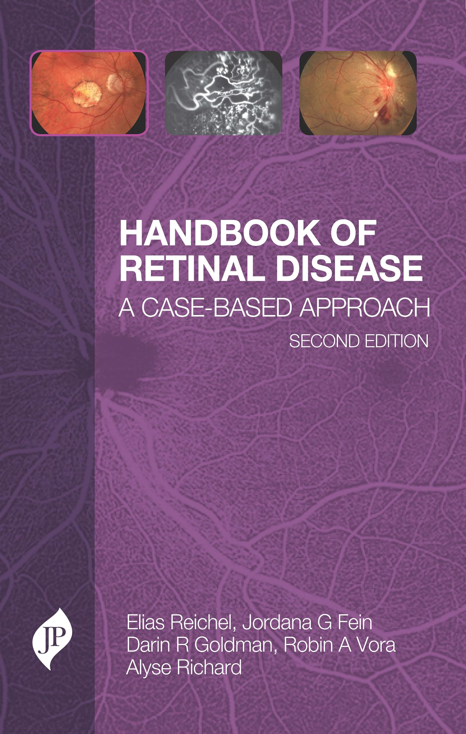 Handbook of Retinal Disease: A Case- Based Approach (English Edition)