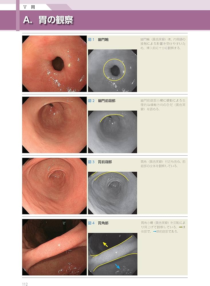消化管内視鏡診断テキスト I 食道・胃・十二指腸 第5版 (消化器