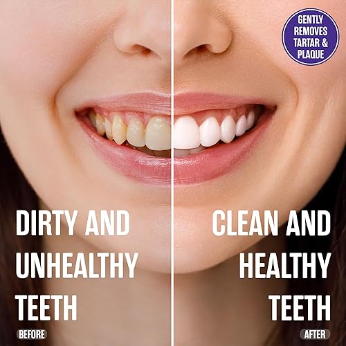 Miniatura 7 de SprinJene Alivio natural de la sensibilidad, pasta de dientes sin flúor para dientes sensibles (paquete de 4) + enjuague bucal sin flúor y sin