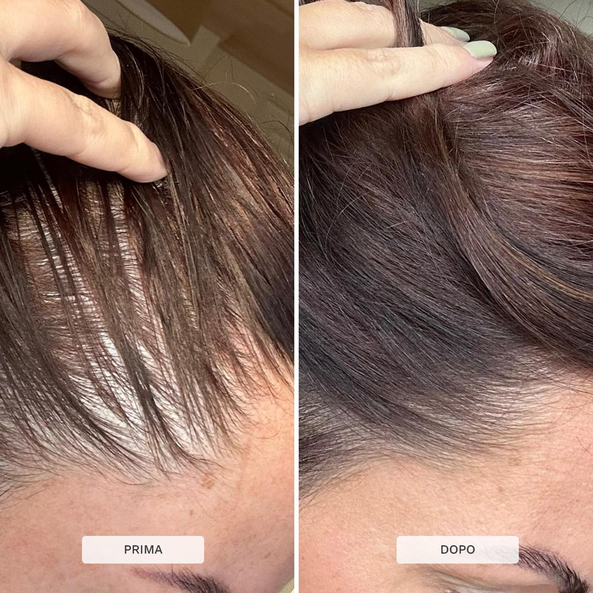 HAIR BURST Gomme Vitaminiche per Capelli Biotina per capelli più Lunghi e Spessi — Aggiunta di Zinco, Vitamina C e Selenio - Fornitura per 1 Mese (Confezione da 60 Caramelle Gommose)