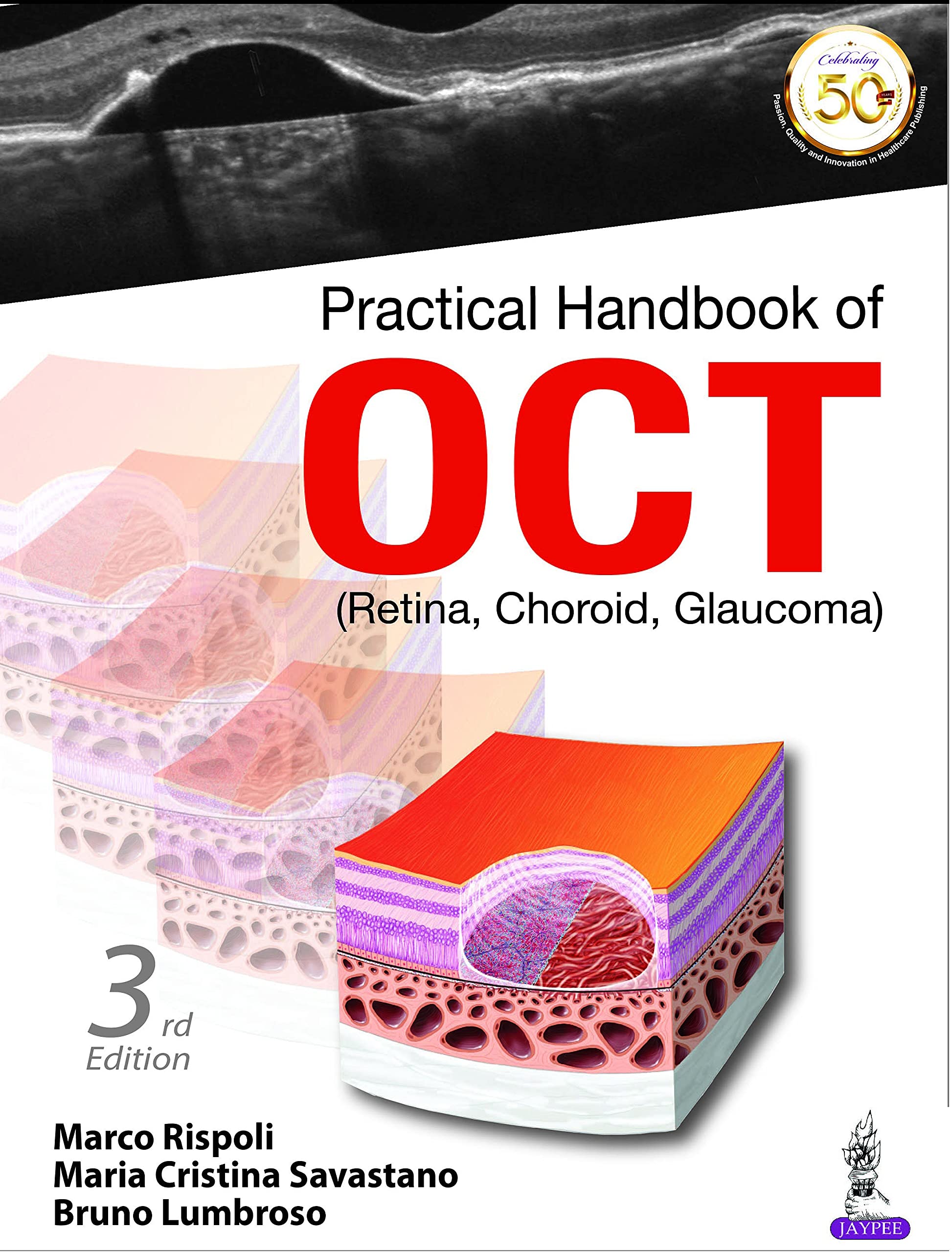 Practical Handbook Of OCT (Retina, Choroid, Glaucoma) (English Edition)