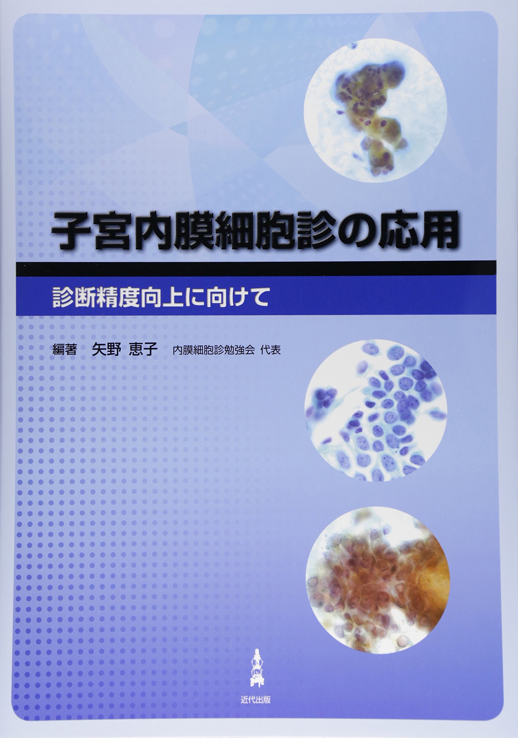 Amazon.co.jp: 子宮内膜細胞診の応用: 診断精度向上に向けて : 矢野