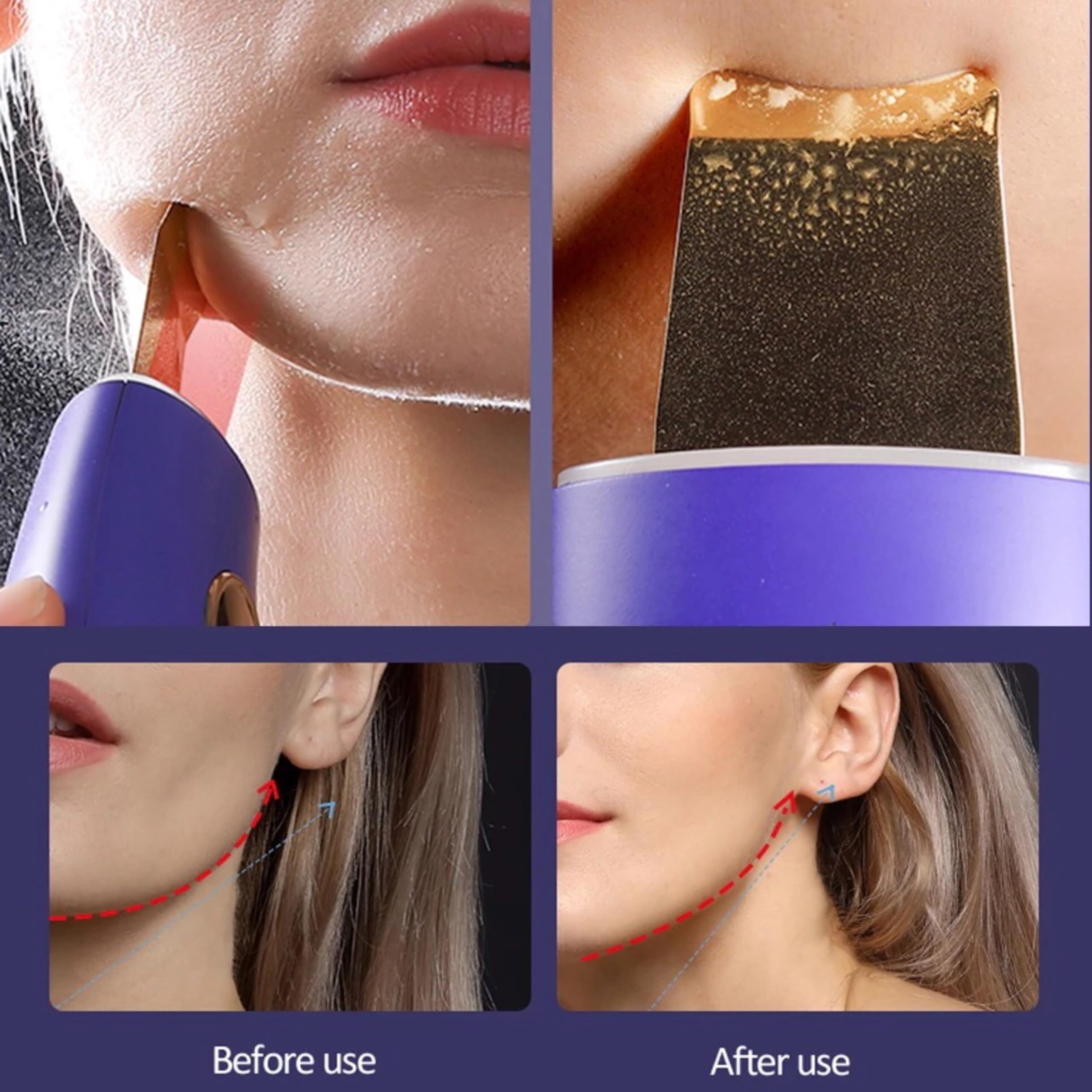 Lalano´S Cosmetics Golden Skin Scrubber - Pulitore per viso ad ultrasuoni, spatola dorata 24 K, EMS Lifting, tecnologia ionica, terapia a LED, rimozione punti neri e pulitore per pori, senza fili