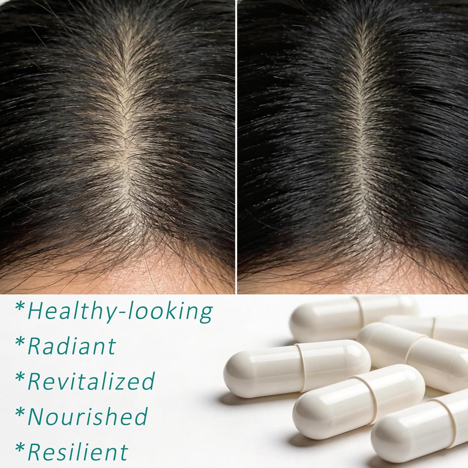 Hair Growth Biotin 10000mcg Supplement with Vitamins A C D E & Calcium - 30-in-1 Formula for Hair & Nails Support, for Women & Men, 30 Servings (1)