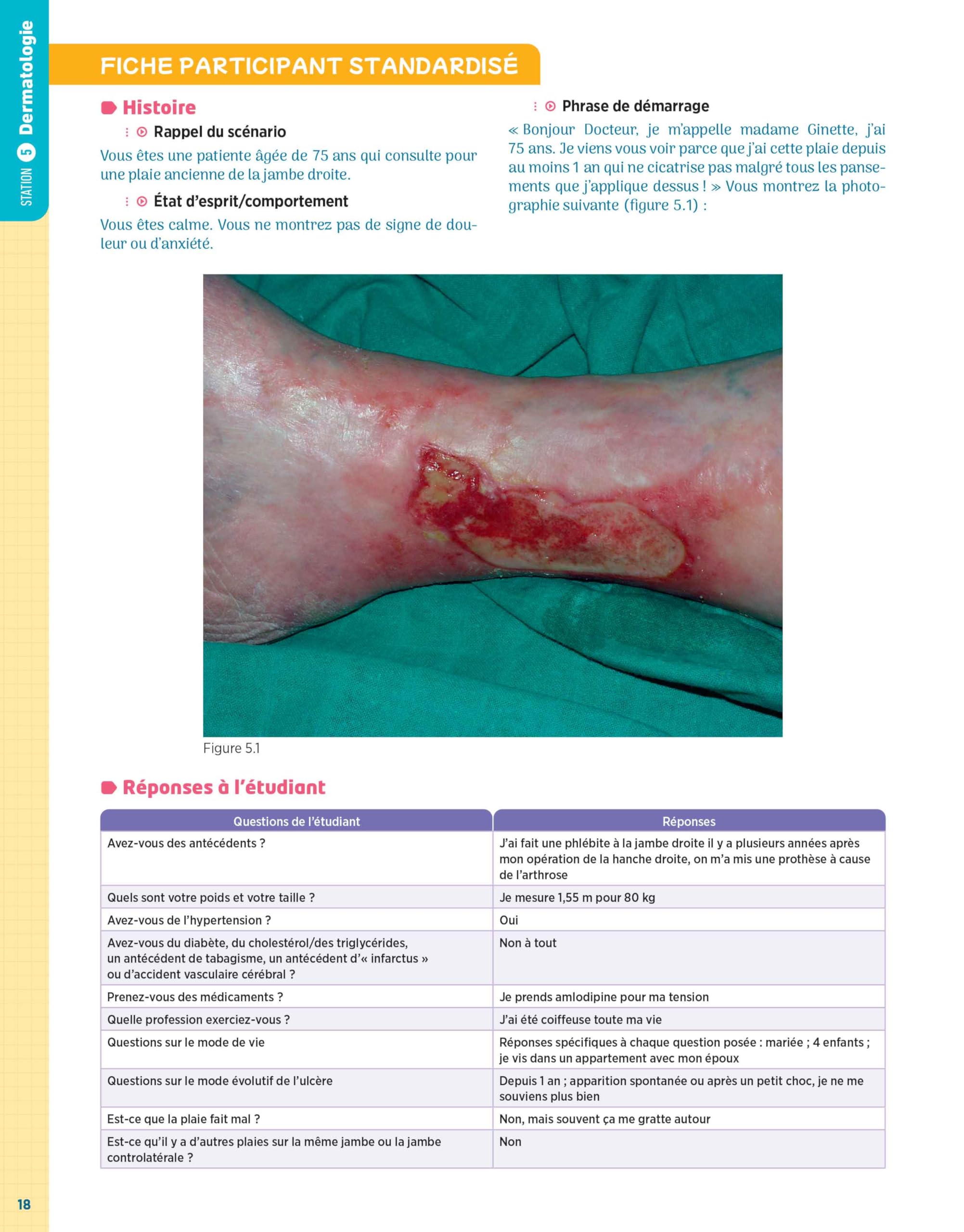 ECOS La compil' 1 - Dermatologie/Endocrinologie-Diabétologie/MPR/Nutrition/Rhumatologie: Dermato Endoc Mpr Nutr
