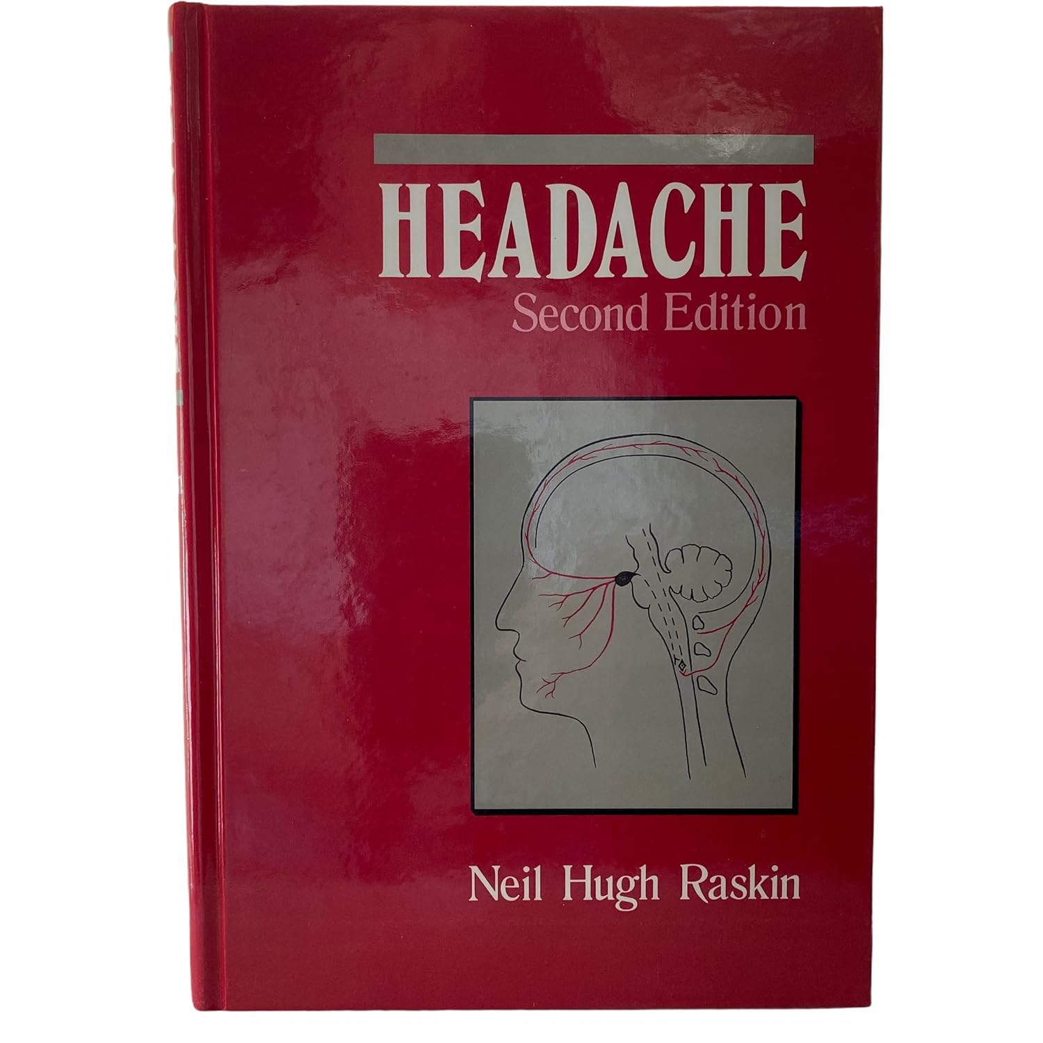 Headache: Raskin, Neil H: 9780443085475: Amazon.com: Books