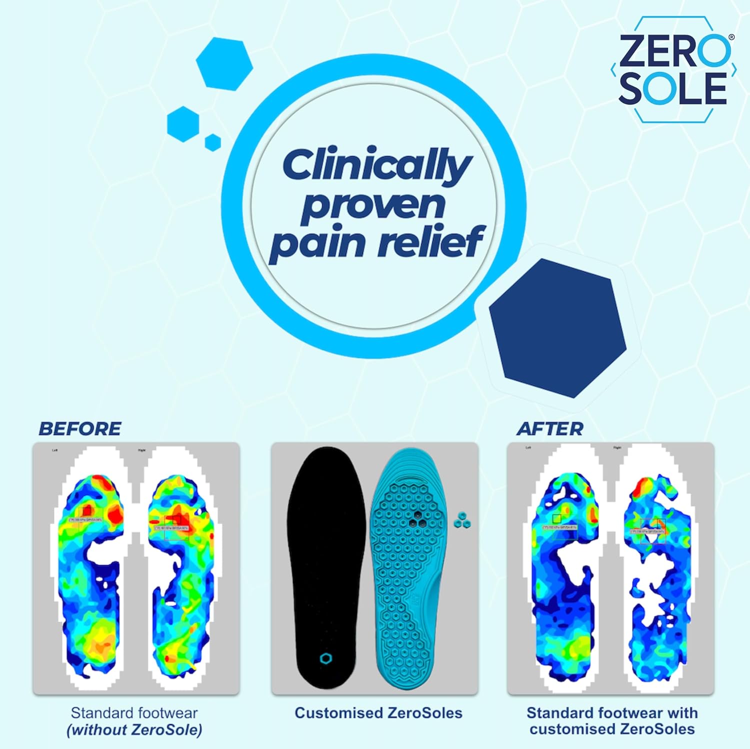 Customizable Corn & Callus Relief Insoles – Clinically Proven, Podiatrist-Designed Pressure-Relief Insoles for Corns, Calluses, Metatarsalgia & Plantar Fasciitis (Small - Medium | US 5-8)