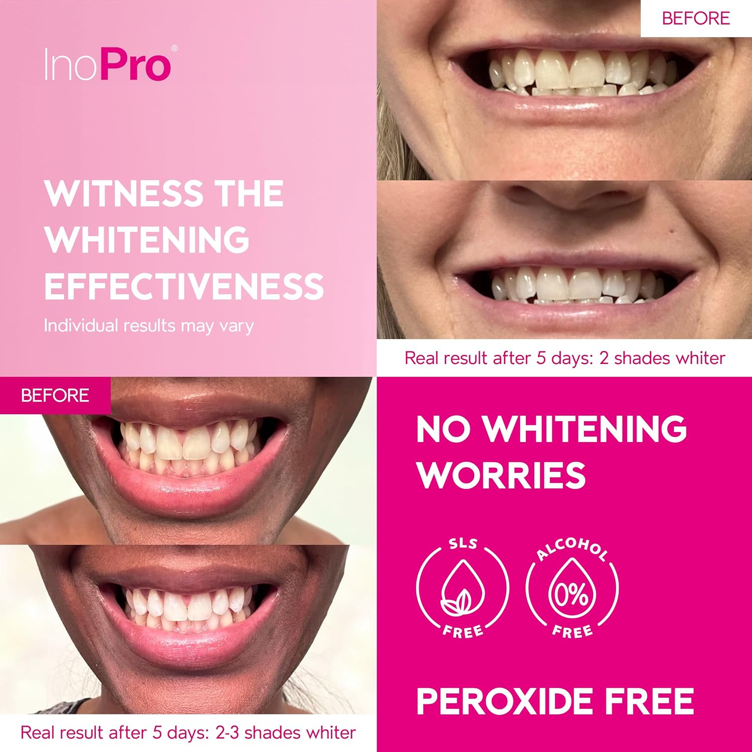 Crest 3D Whitestrips Professional Effects