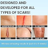 Vista 3 de Scarguard MD 0.5 onzas líquidas