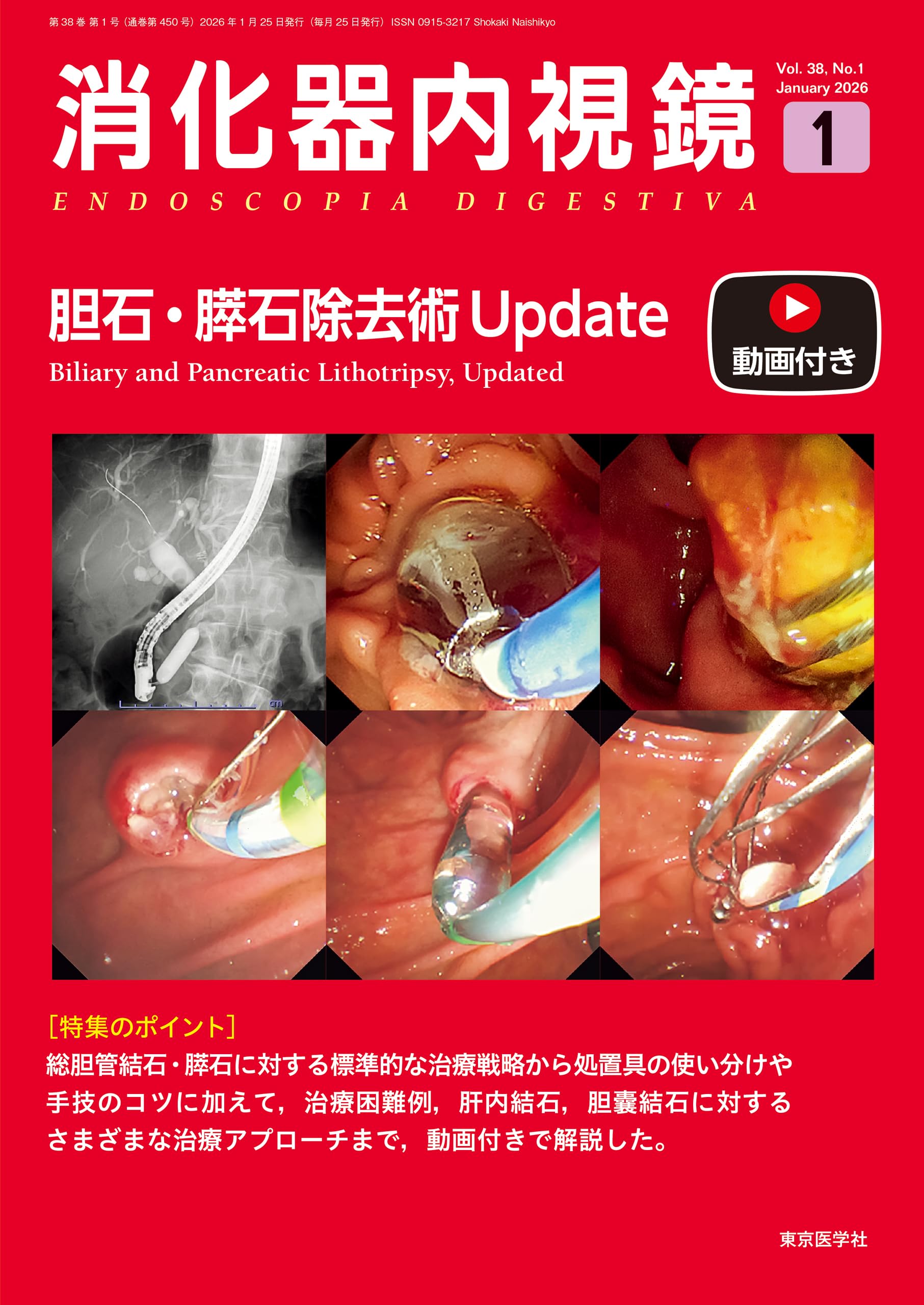 消化器内視鏡38巻1号2026年1月号 胆石・膵石除去術Update | 「消化器内