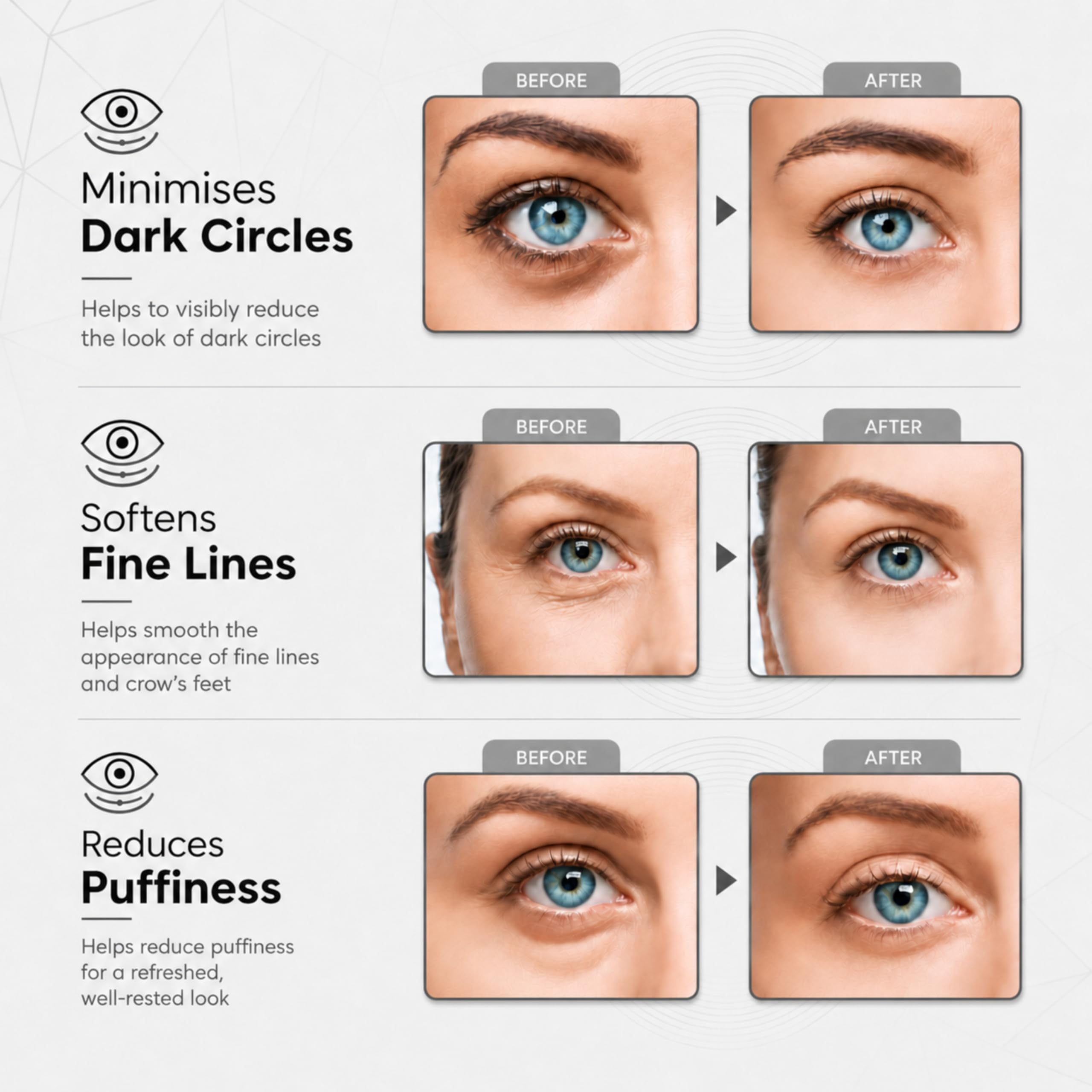Revitale Under Eye Patchs