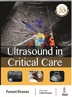 ULTRASOUND IN CRITICAL CARE