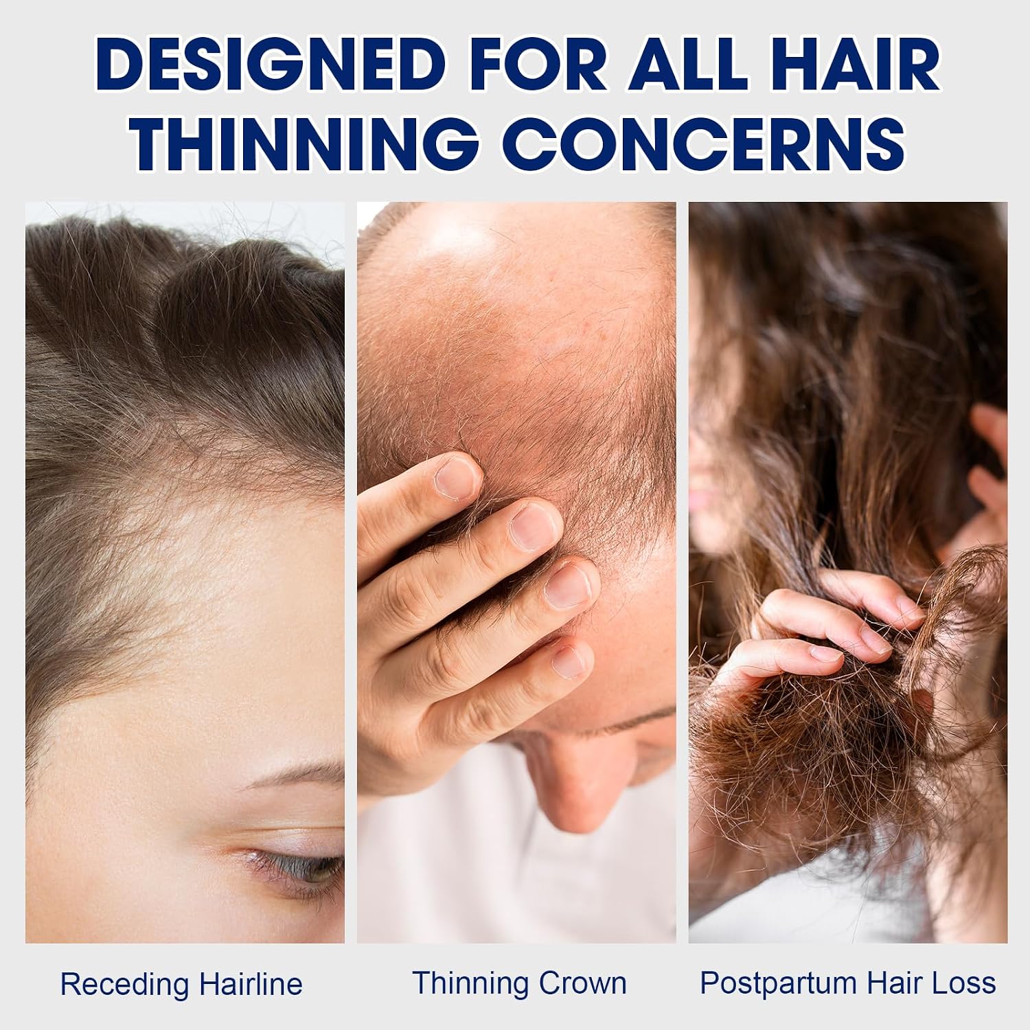 GHK-Cu Copper Peptide Hair & Scalp Serum for Thinning Hair, Copper Peptides for Hair Growth Support, Lightweight Daily Scalp Care with Niacinamide, Panthenol for Fuller-Looking Hair, Softness & Shine