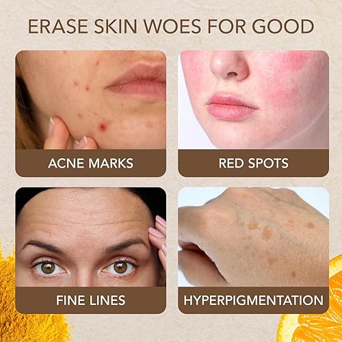 Miniatura 5 de Jabón de ácido kójico, barra de jabón de cúrcuma y naranja, jabón de ácido kójico para hiperpigmentación, ayuda a reducir las manchas oscuras, jabón