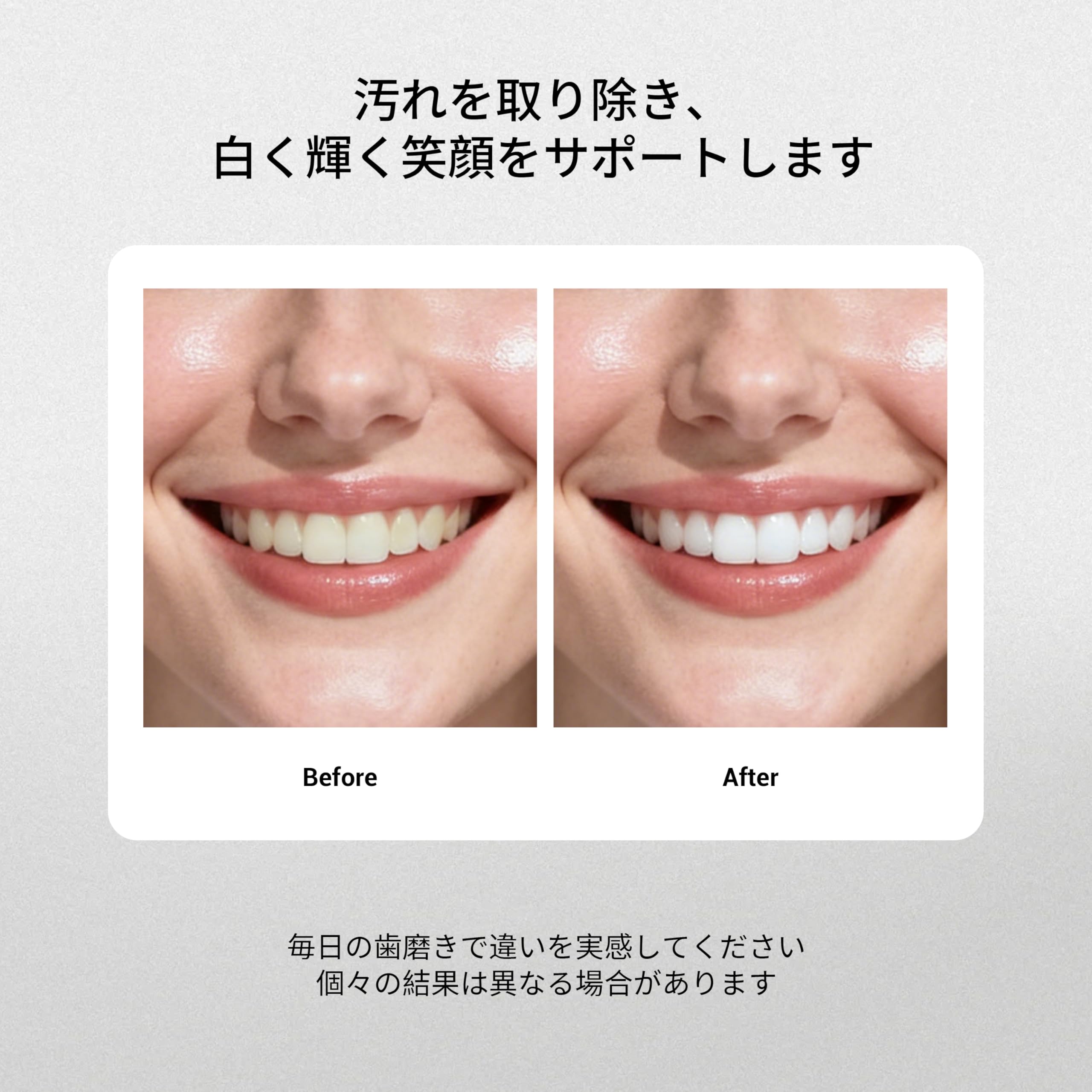 Amazon | MSDRWIKEY ポッピング 7Proホワイトニング歯磨き粉 120g | 7