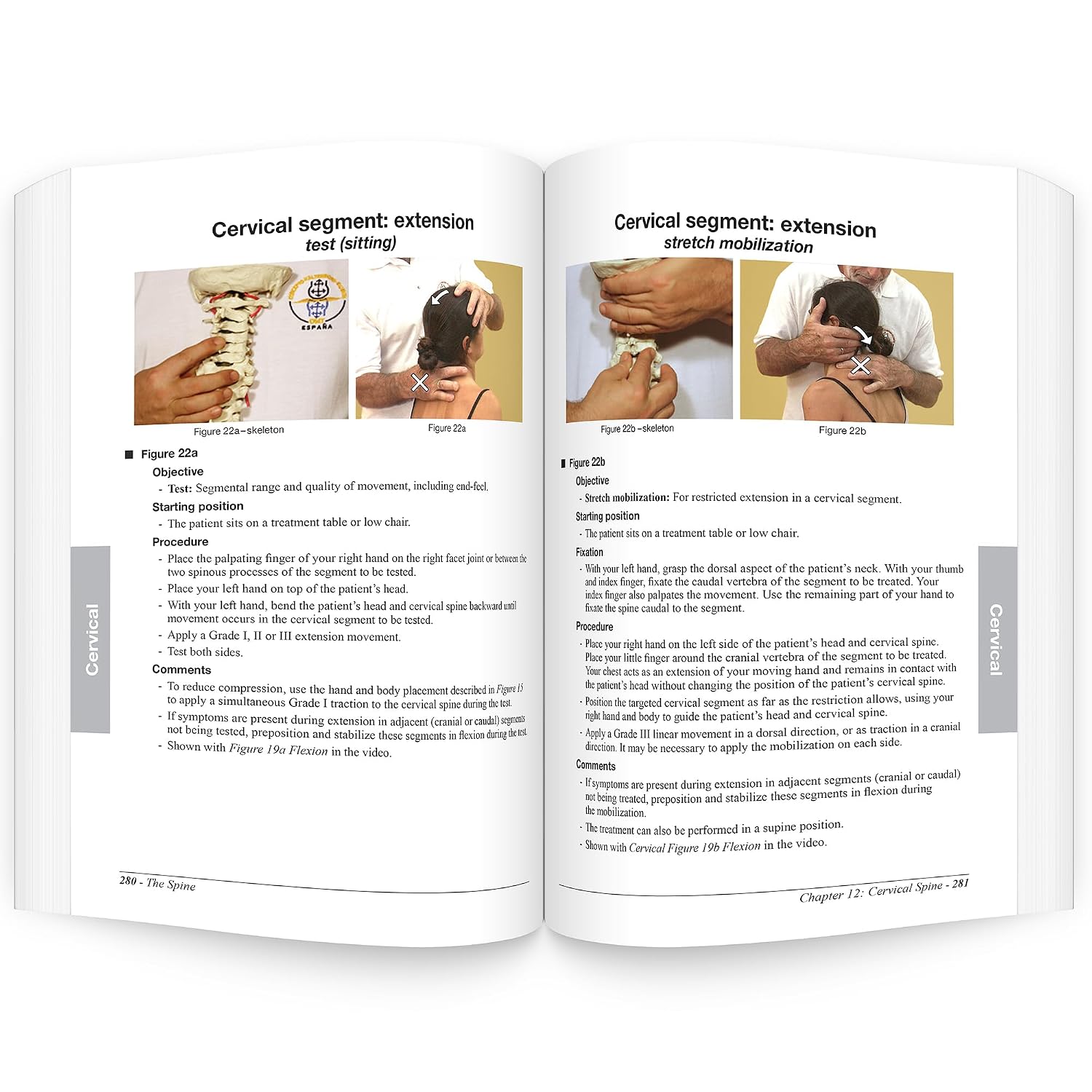 Manual Mobilization of the Joints, Volume II: The Spine