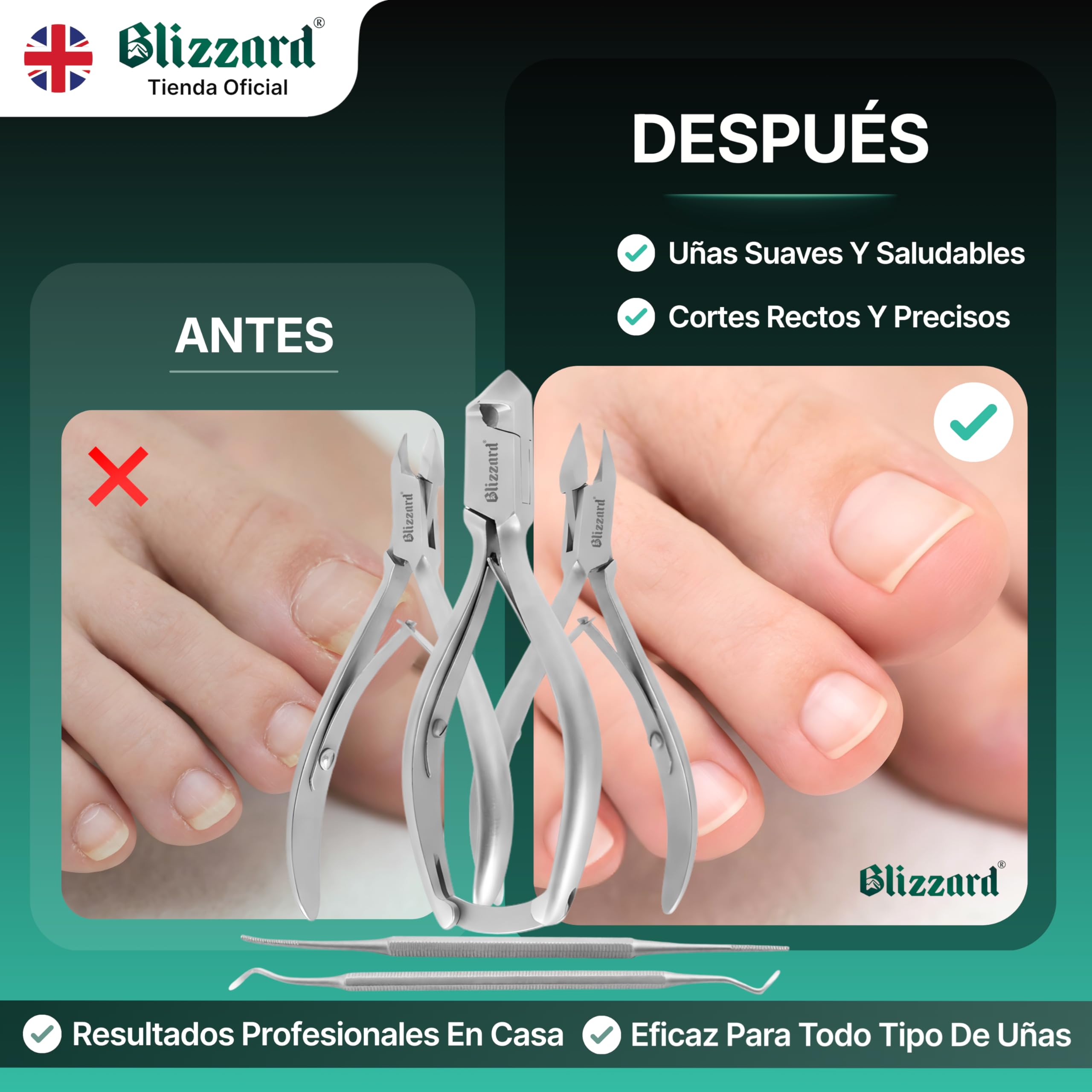 Blizzard Set de Podología Profesional 5 Piezas - Kit Pedicura para Uñas Gruesas y Encarnadas - Herramientas de Acero Inoxidable con Cortaúñas Alicates Cortacutículas Lima Elevador Podología Completo