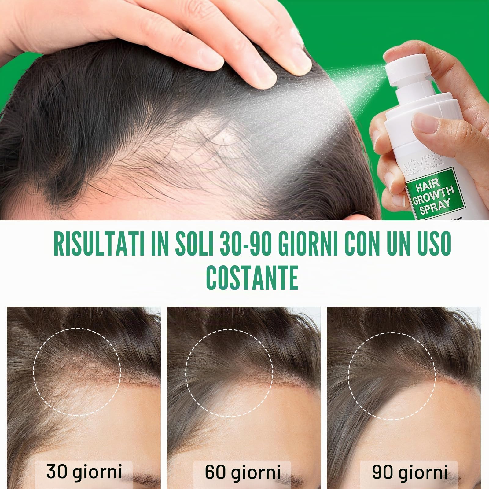 Spray di siero per la crescita dei capelli, olio naturale per la crescita dei capelli con olio biologico di rosmarino, olio di ricino, olio Batana e biotina, crescita dei capelli più sottili