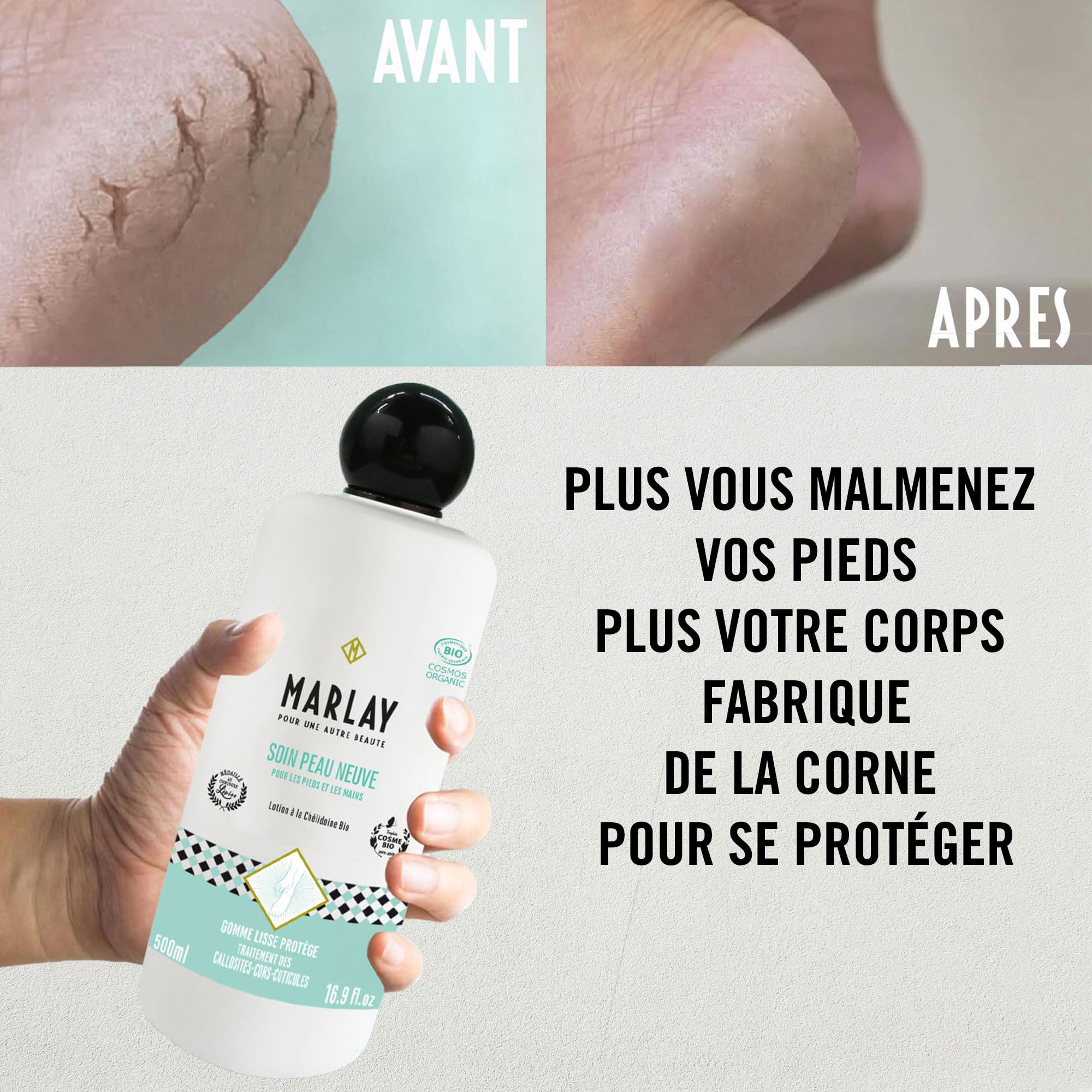 Marlay Cosmetics - Soin Peau Neuve 500 ml - Lotion Pieds Secs et Abimés à la Chélidoine Bio - 99% Origine Naturelle - Soigne Callosités, Cuticules, Cors & Crevasses - Végan - Fabriqué en France