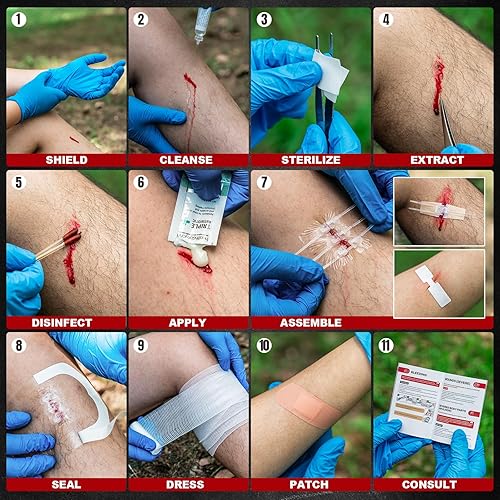 Miniatura 4 de RHINO RESCUE Kit de cierre de heridas, 3 tipos de vendajes de mariposa con vendajes, ungüento antibiótico triple, tiras de cierre de heridas, sin