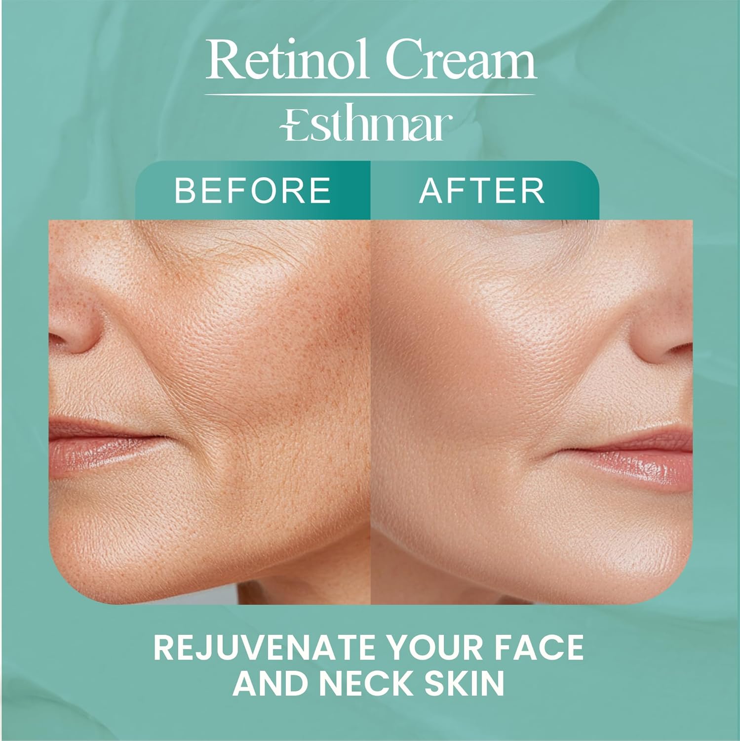 Retinol Face & Neck Cream – Anti-Aging Night Moisturizer with Hyaluronic Acid, Vitamin E & Aloe Vera – Reduces Wrinkles, Fine Lines & Dark Spots, Hydrating for All Skin Types